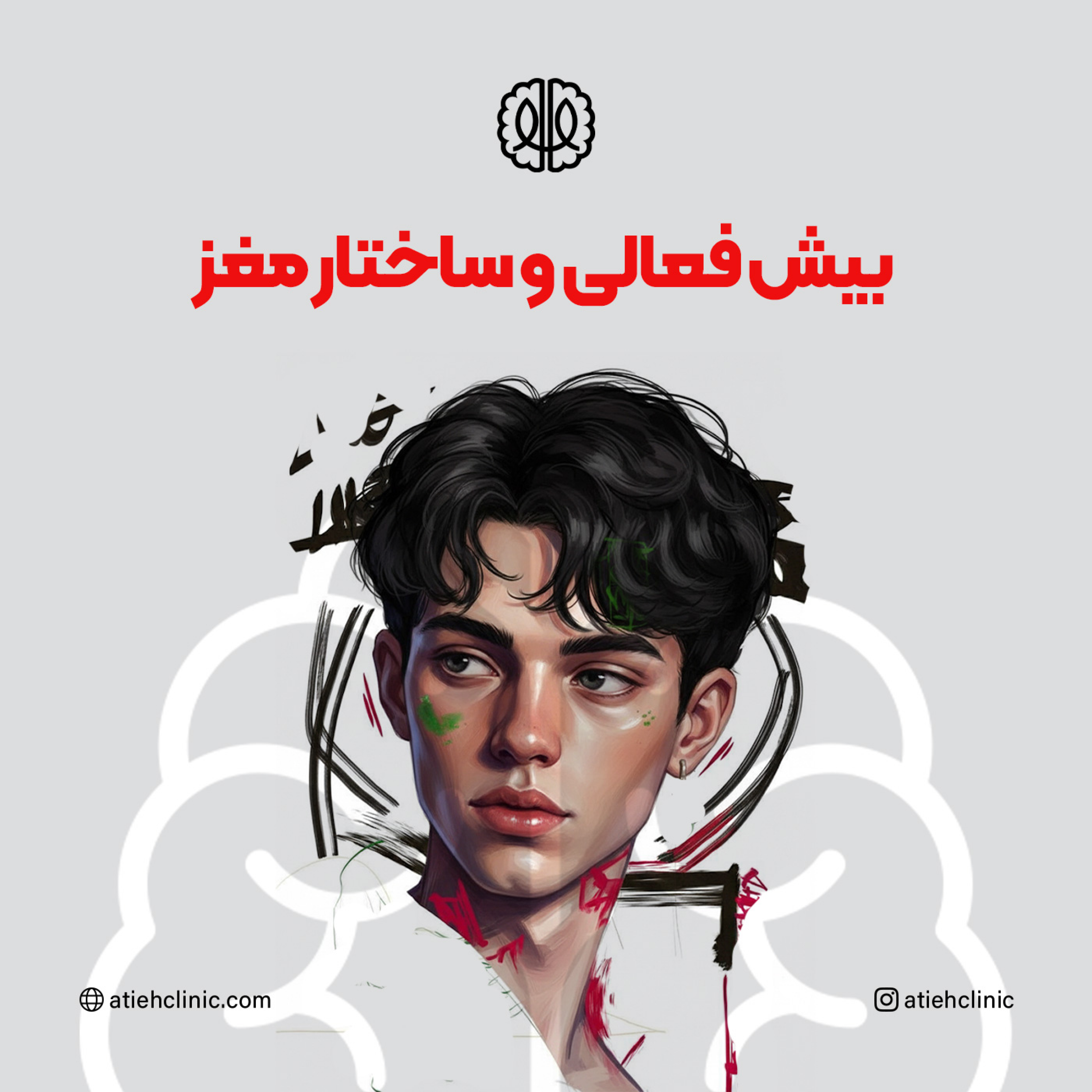 کاور بیش فعالی و ساختار مغز