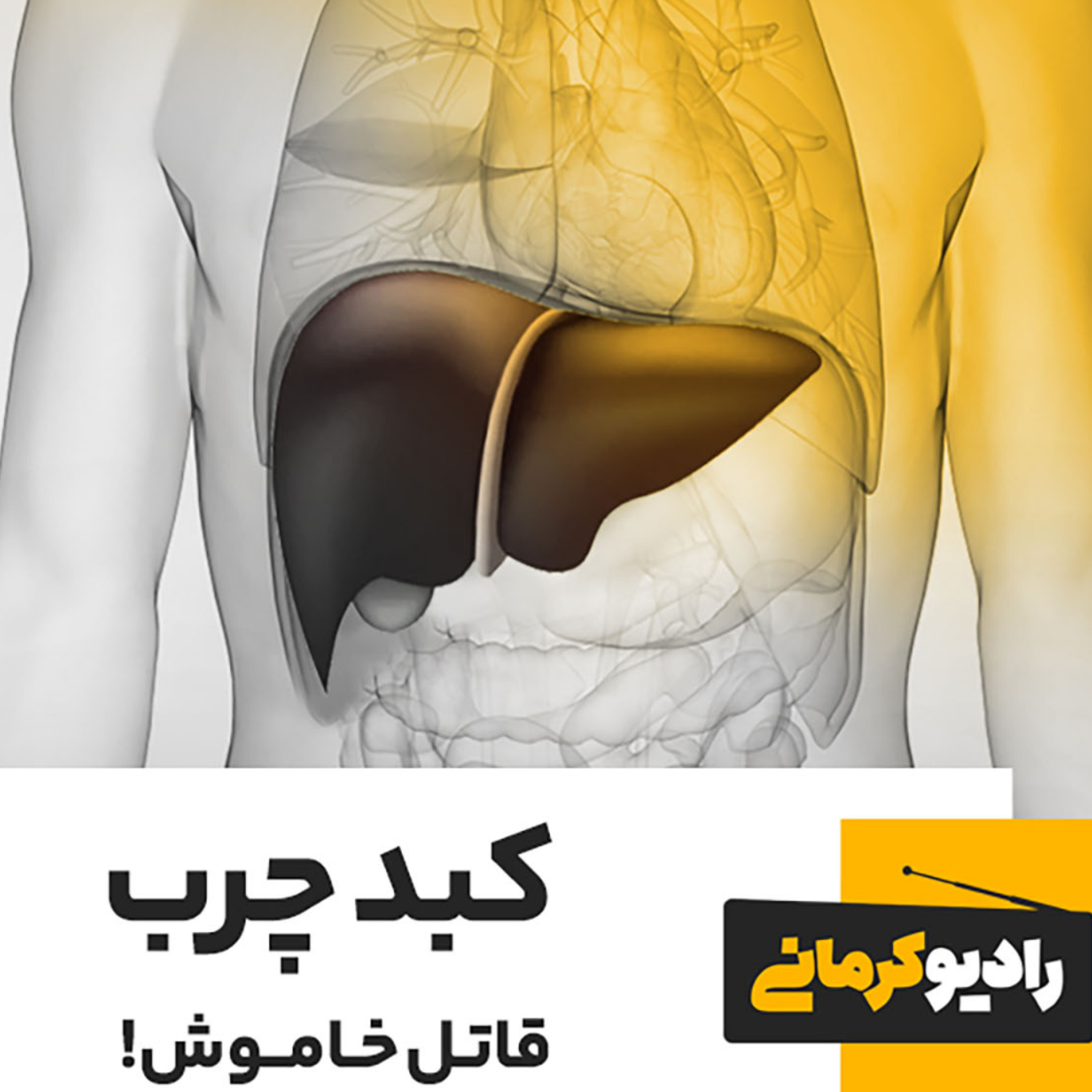 کاور کبد چرب، قاتل خاموش