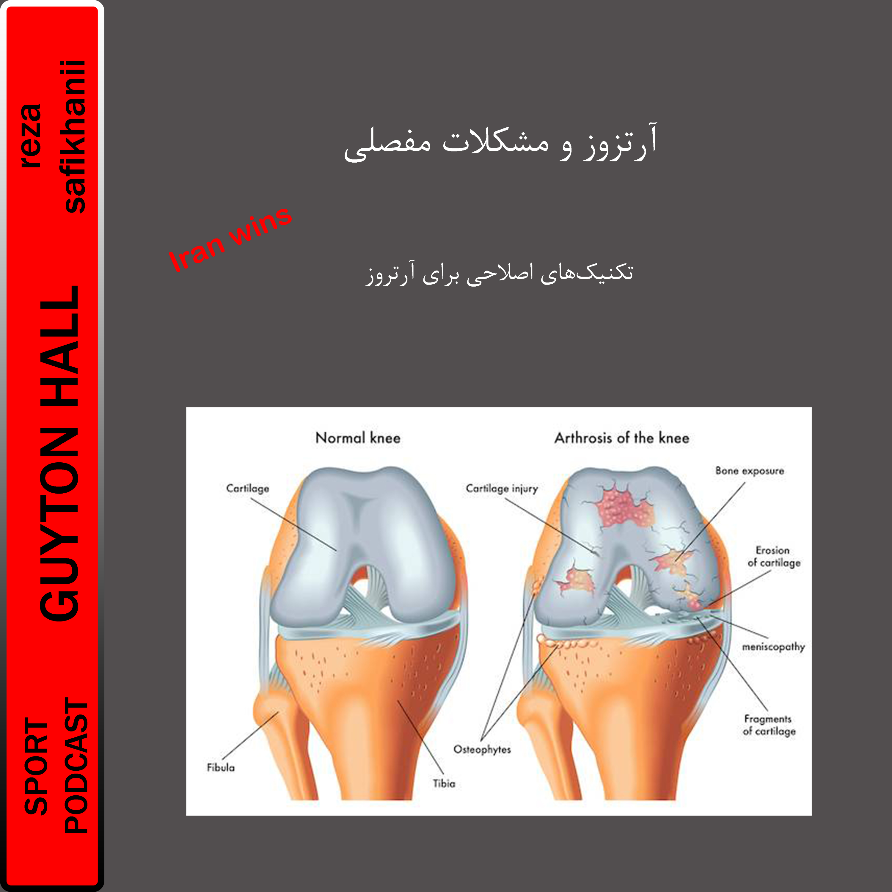 آرتروز و مشکلات مفصلی