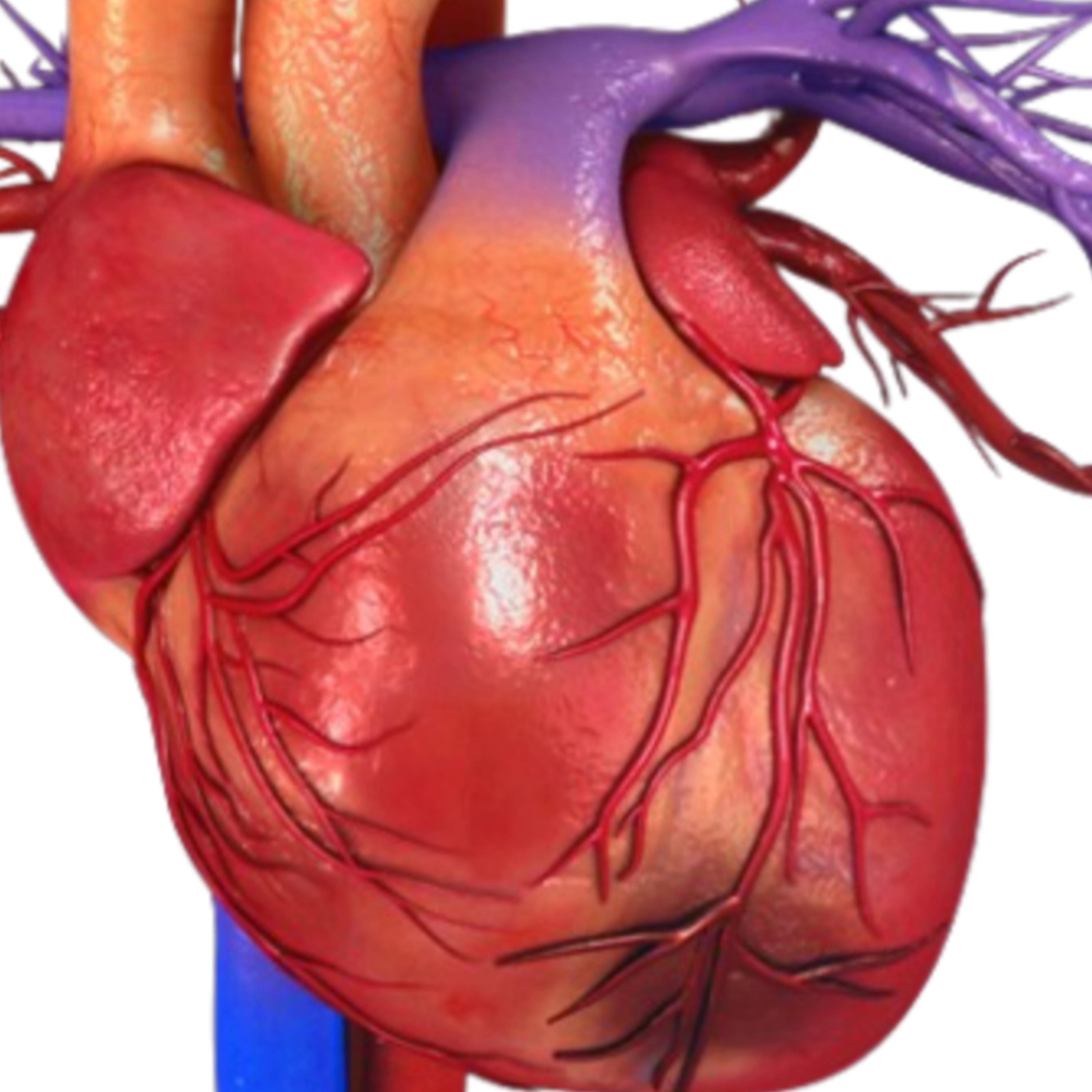 کاور سکته قلبی STEMi