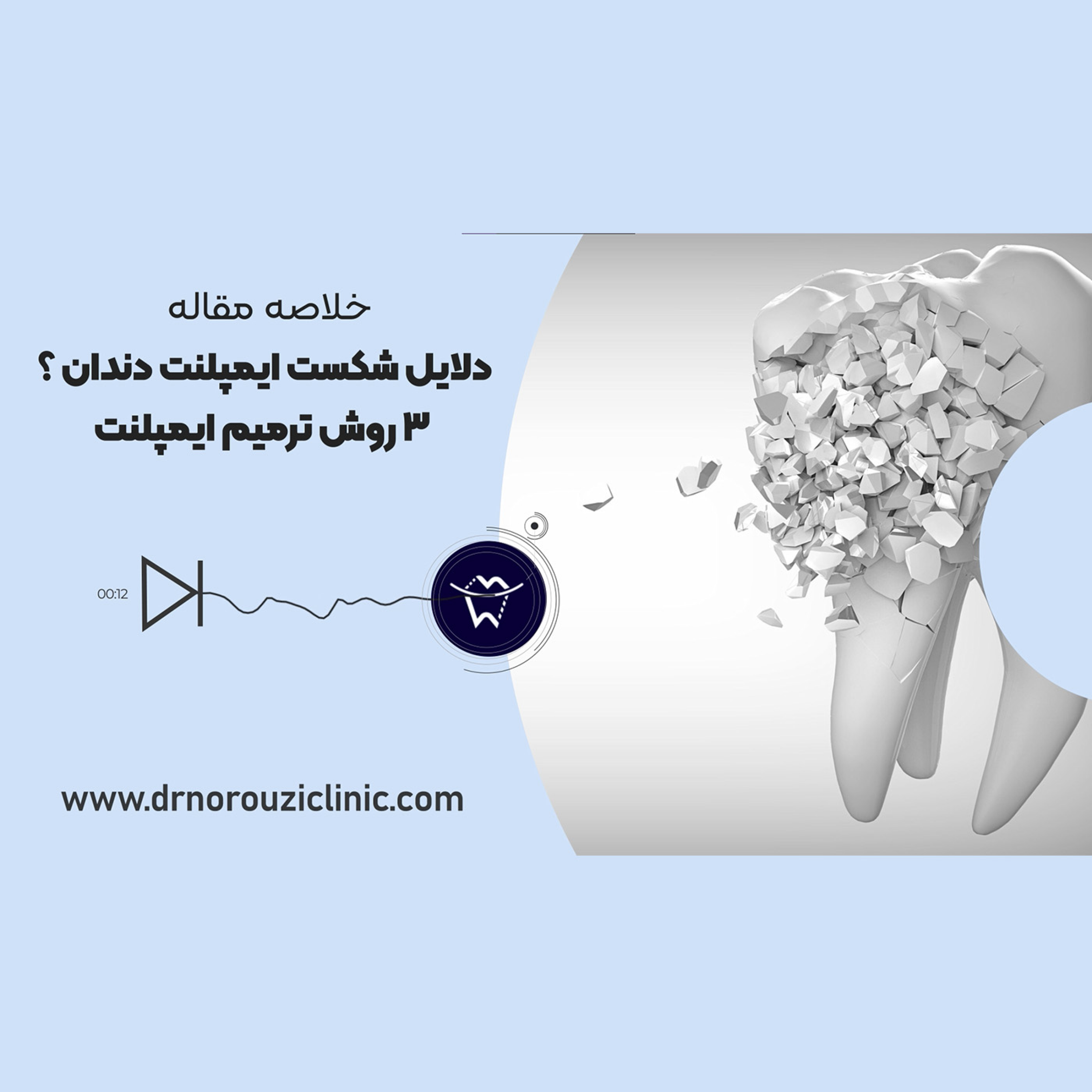 کاور دلایل شکست ایمپلنت دندان؟ ۳ روش ترمیم ایمپلنت