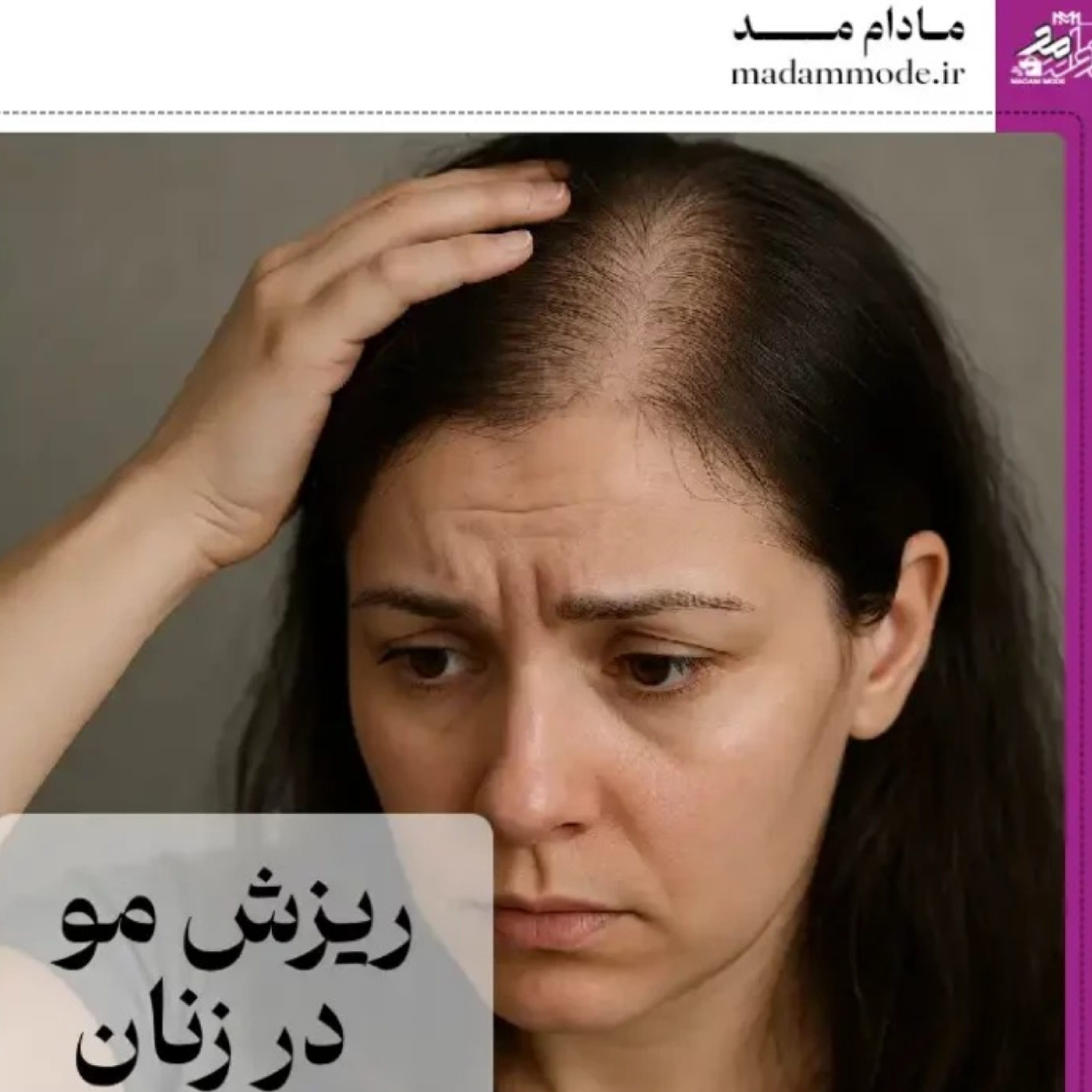 کاور علل ریز مو در زنان