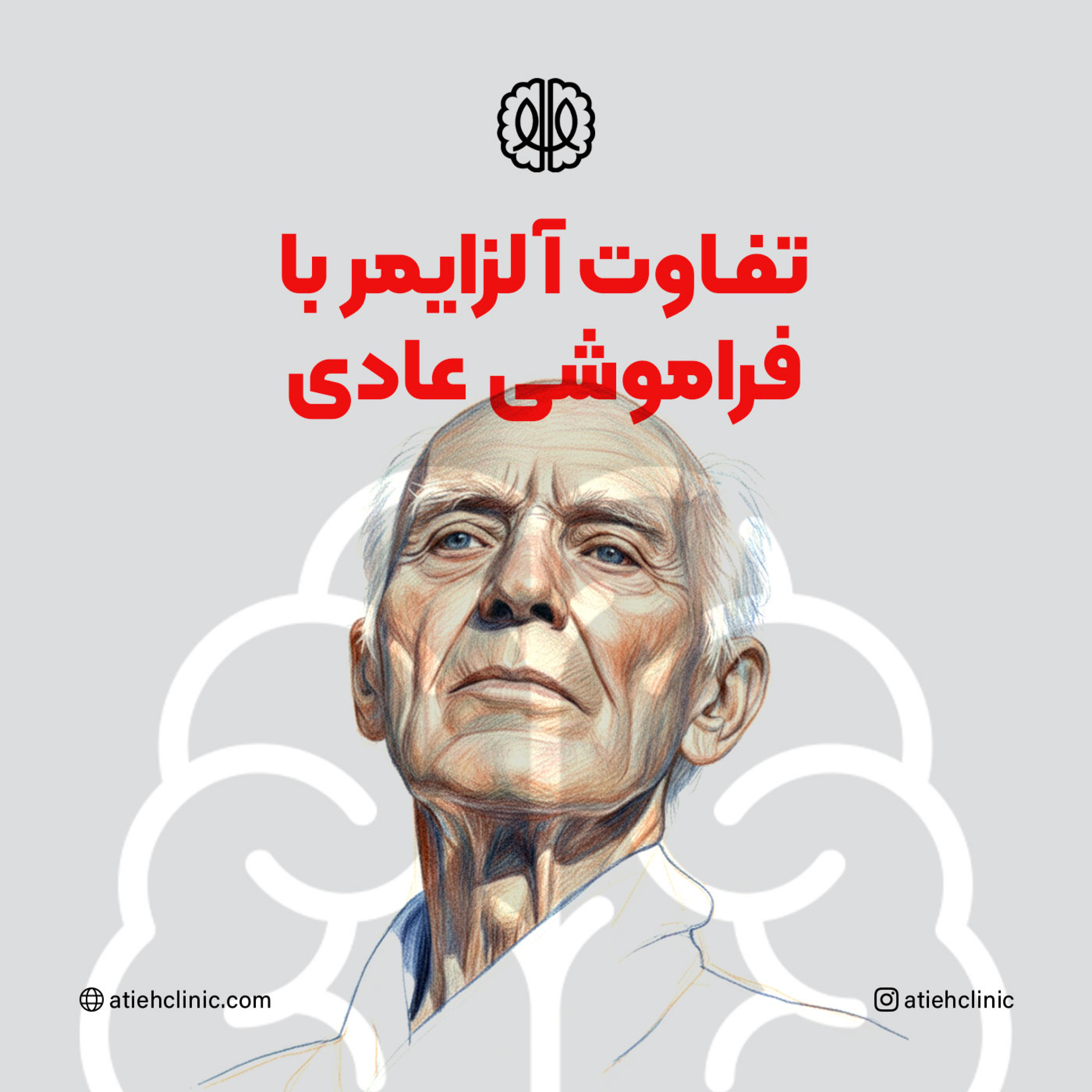 کاور علائم اولیه آلزایمر و تفاوت آن با فراموشی عادی
