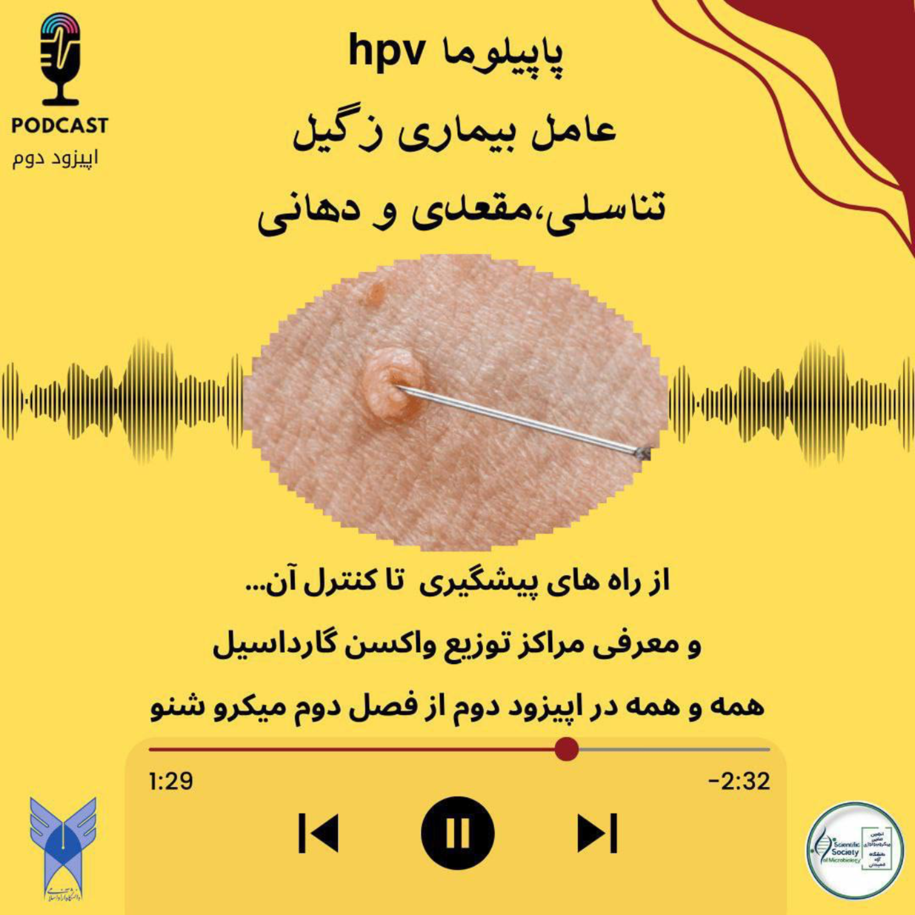 کاور پاپیلوما، عامل زگیل تناسلی
