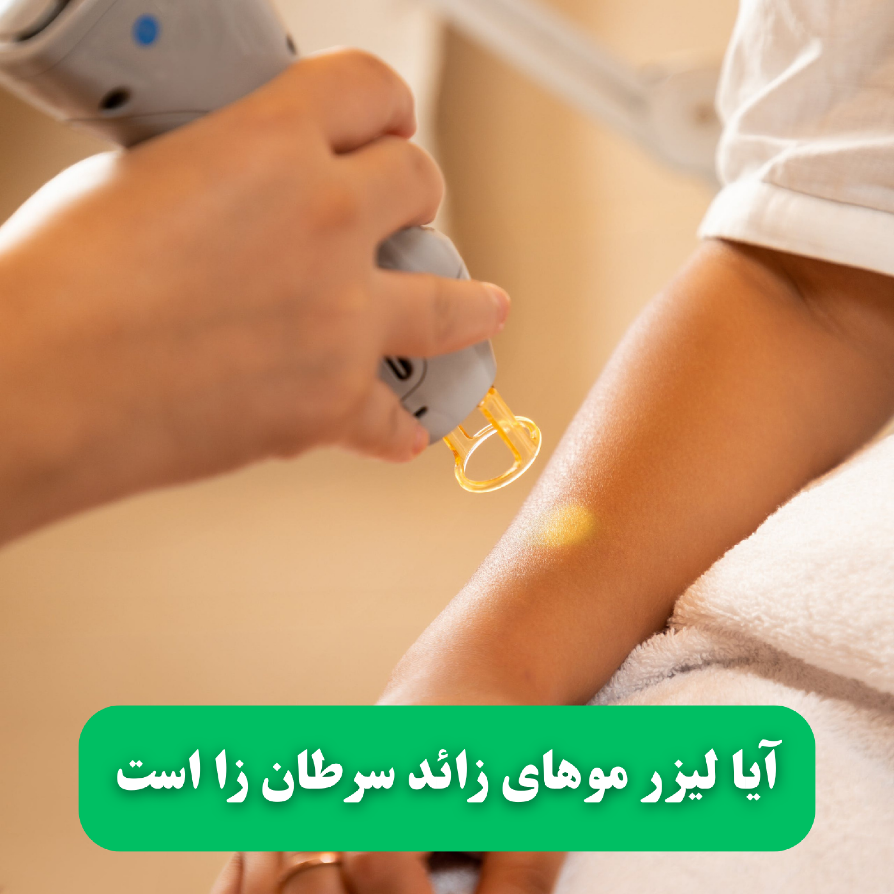 کاور آیا لیزر موهای زائد سرطان زا است