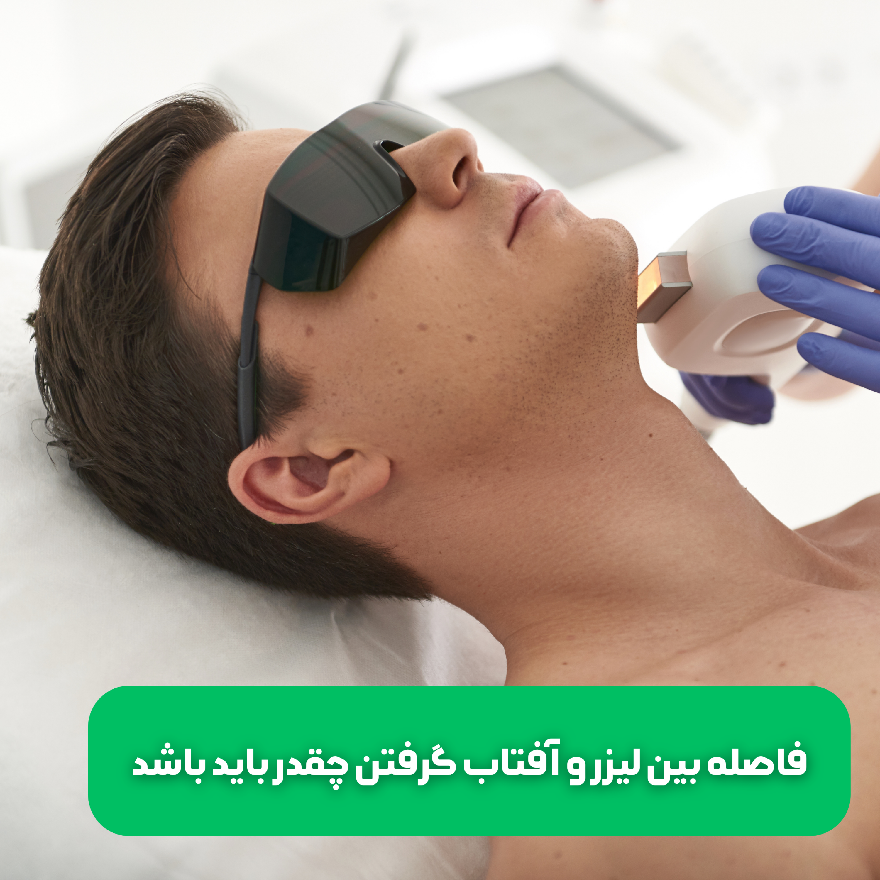 کاور فاصله بین لیزر و آفتاب گرفتن چقدر باید باشد
