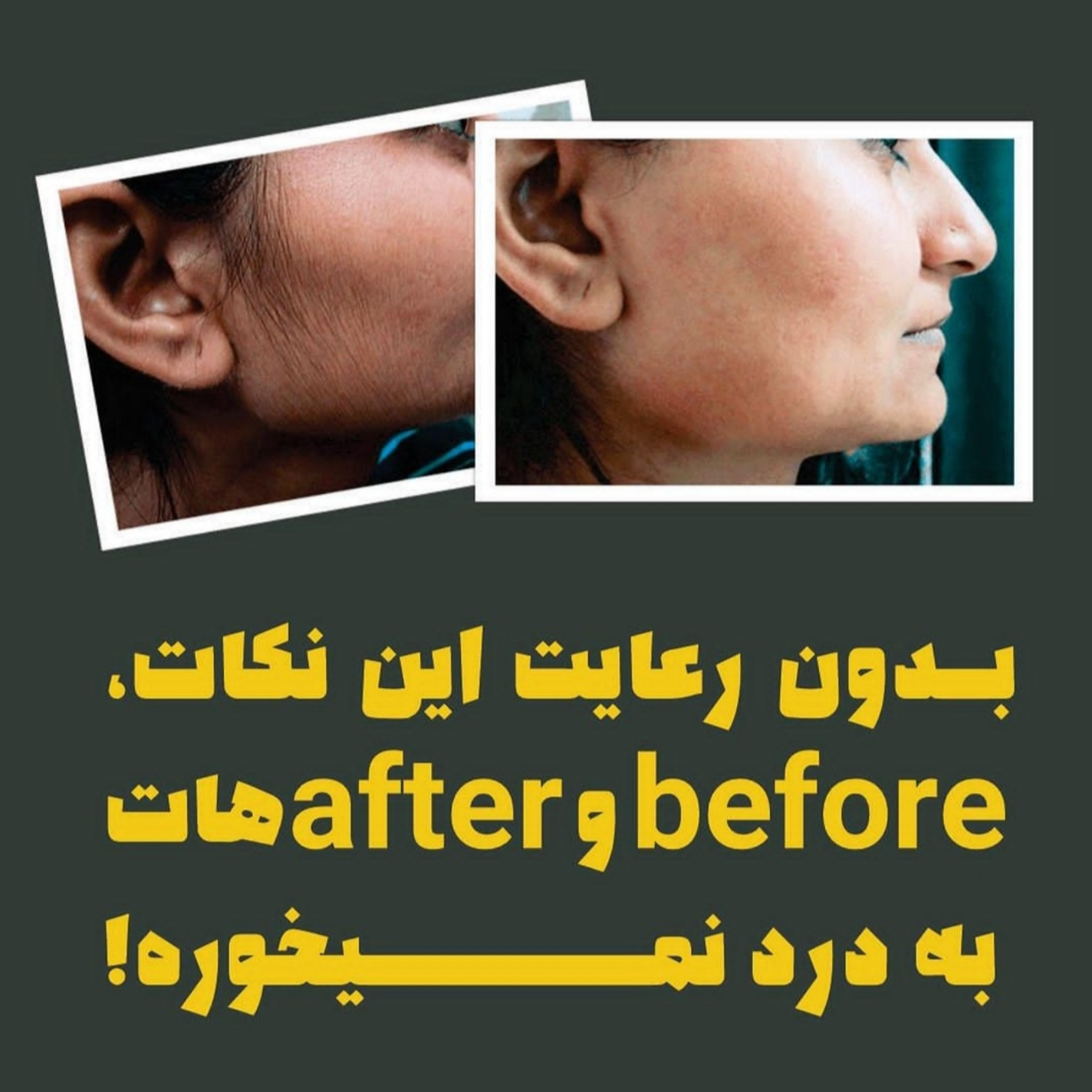 نکات گرفتن عکس قبل و بعد
