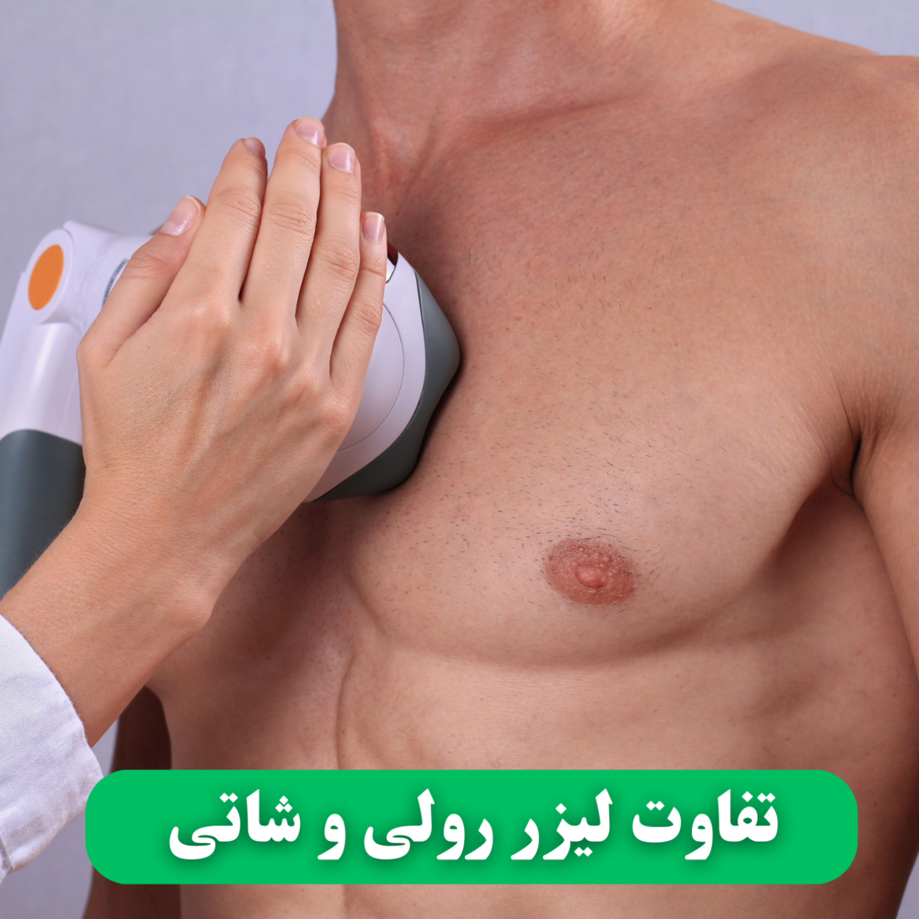 کاور تفاوت لیزر رولی و شاتی
