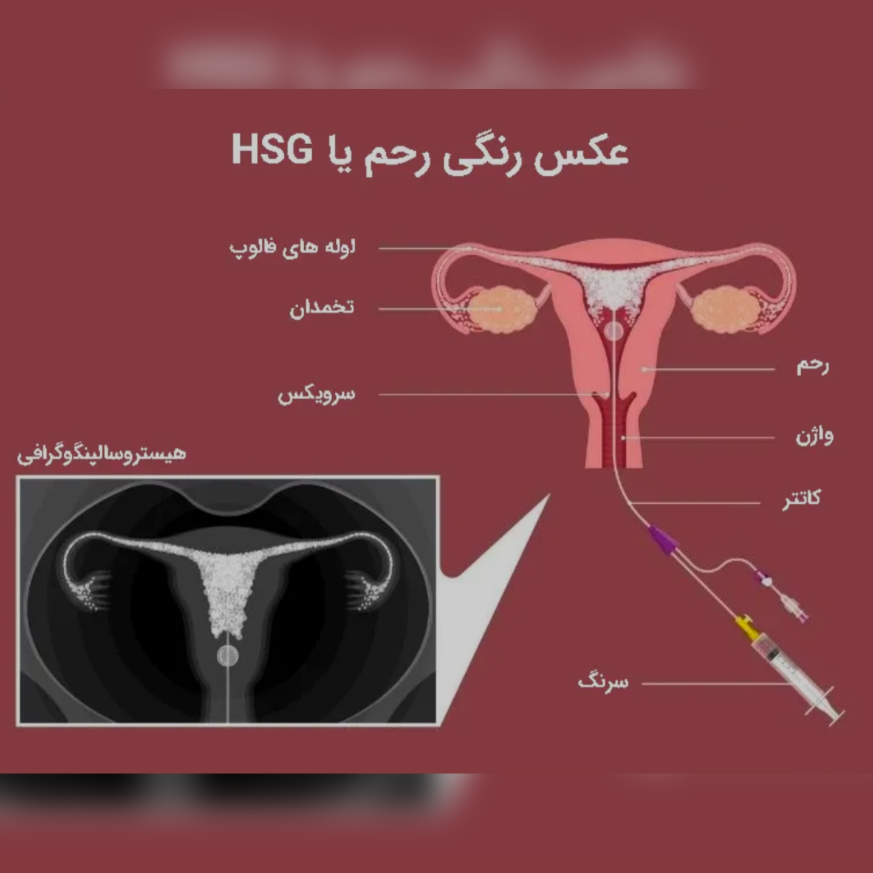 پادکست روزمرگی‌های یک زن - عکس رنگی رحم