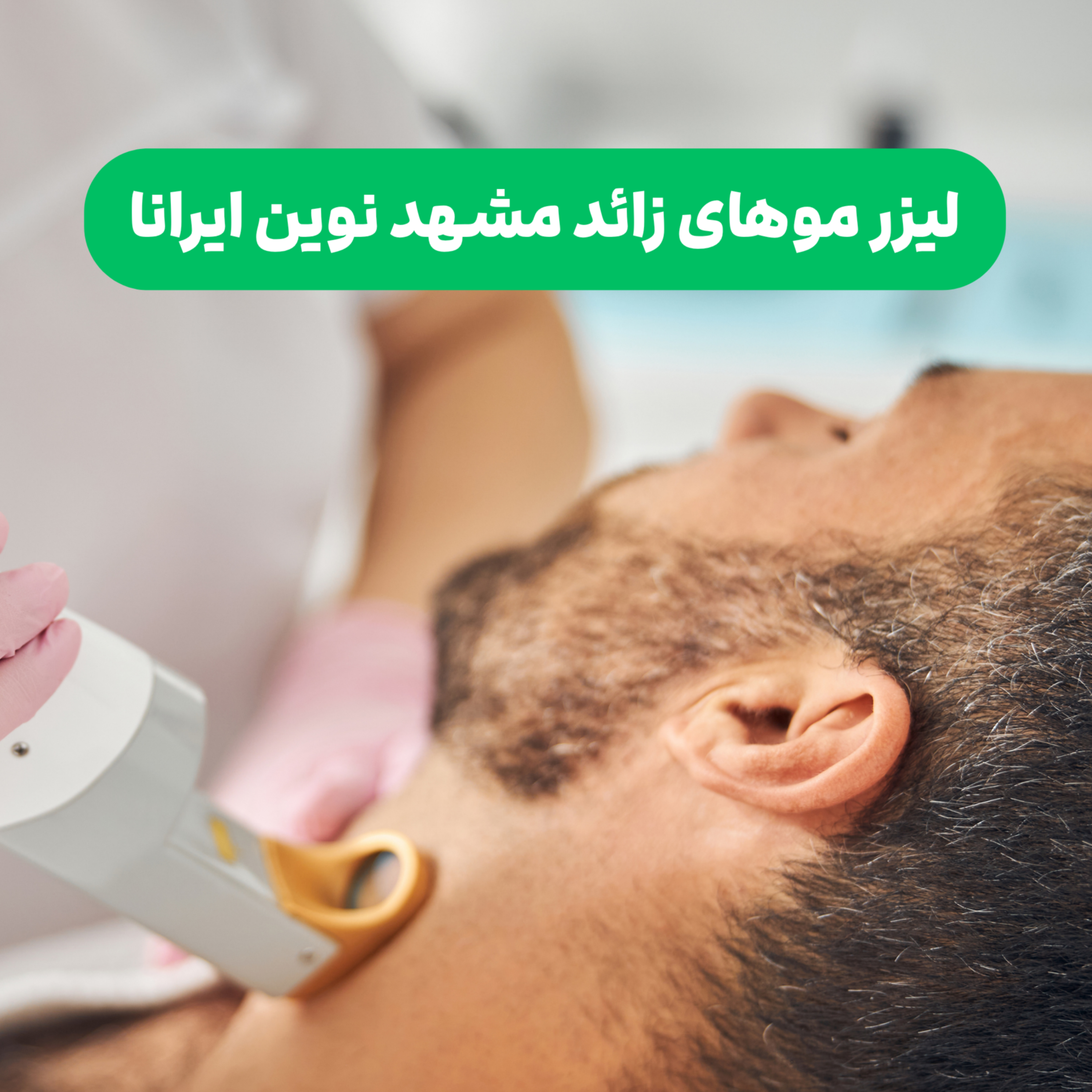 کاور پادکست لیزر موهای زائد مشهد نوین ایرانا