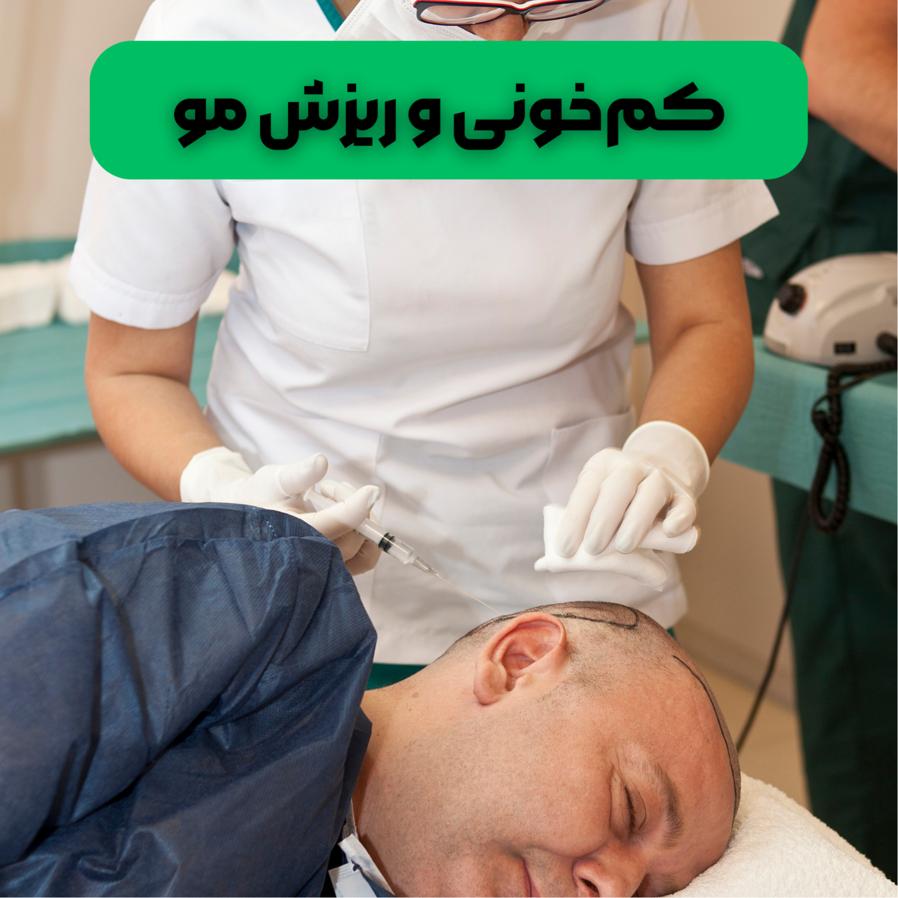کاور رابطه کم‌خونی و ریزش مو؛ از نشانه‌ها تا درمان