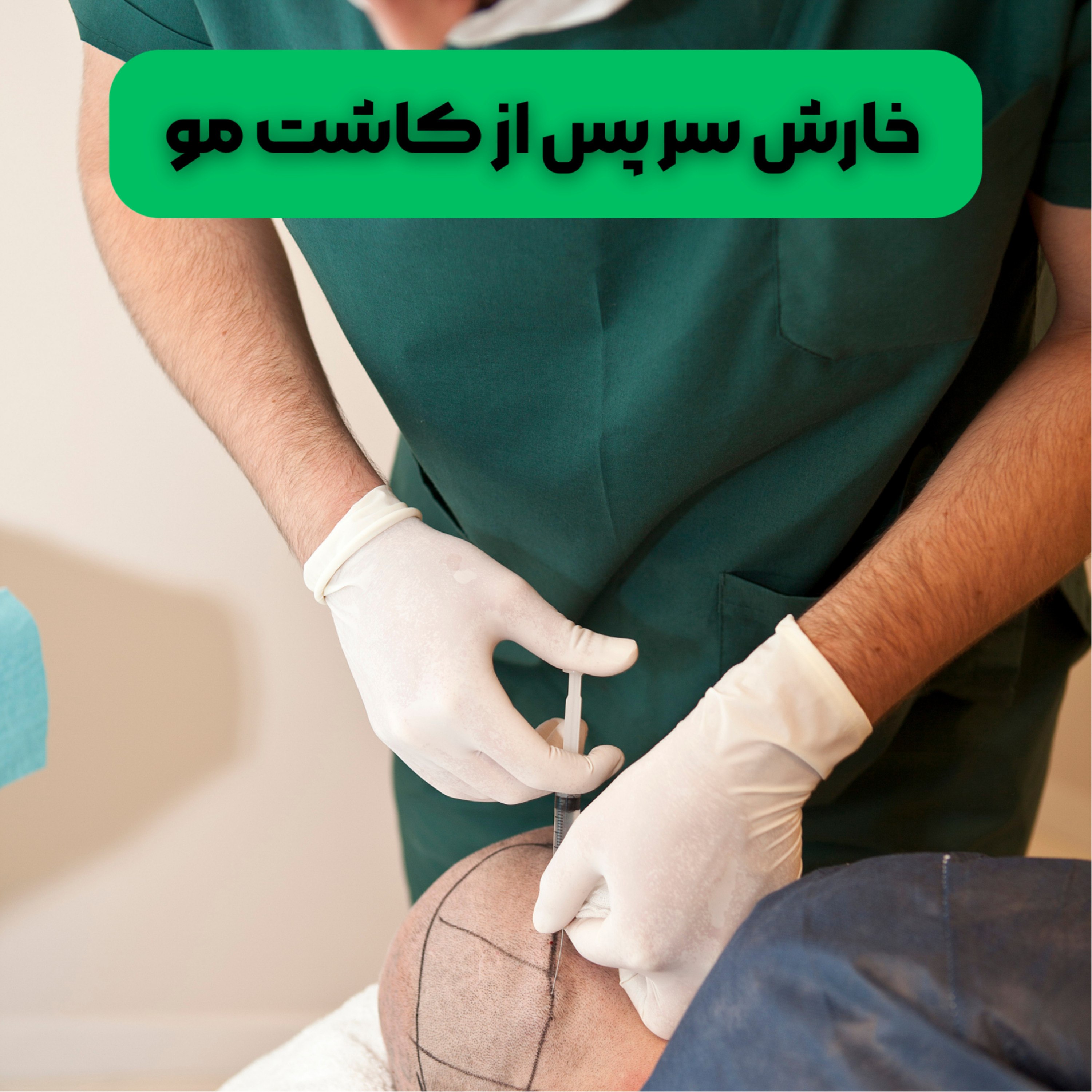 کاور علت و نحوه درمان خارش سر پس از کاشت مو چیست؟