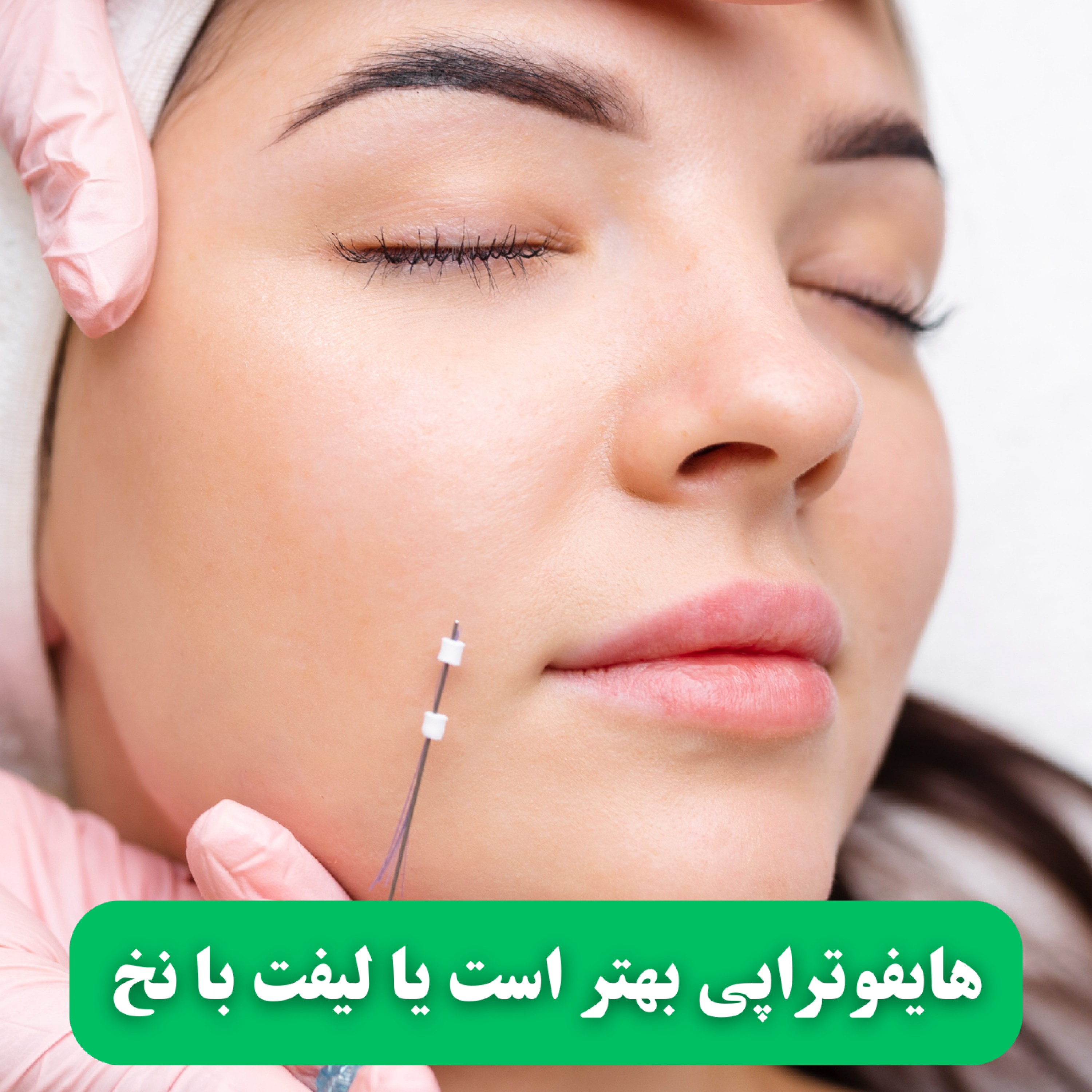 کاور هایفوتراپی بهتر است یا لیفت با نخ | مقایسه روش ها