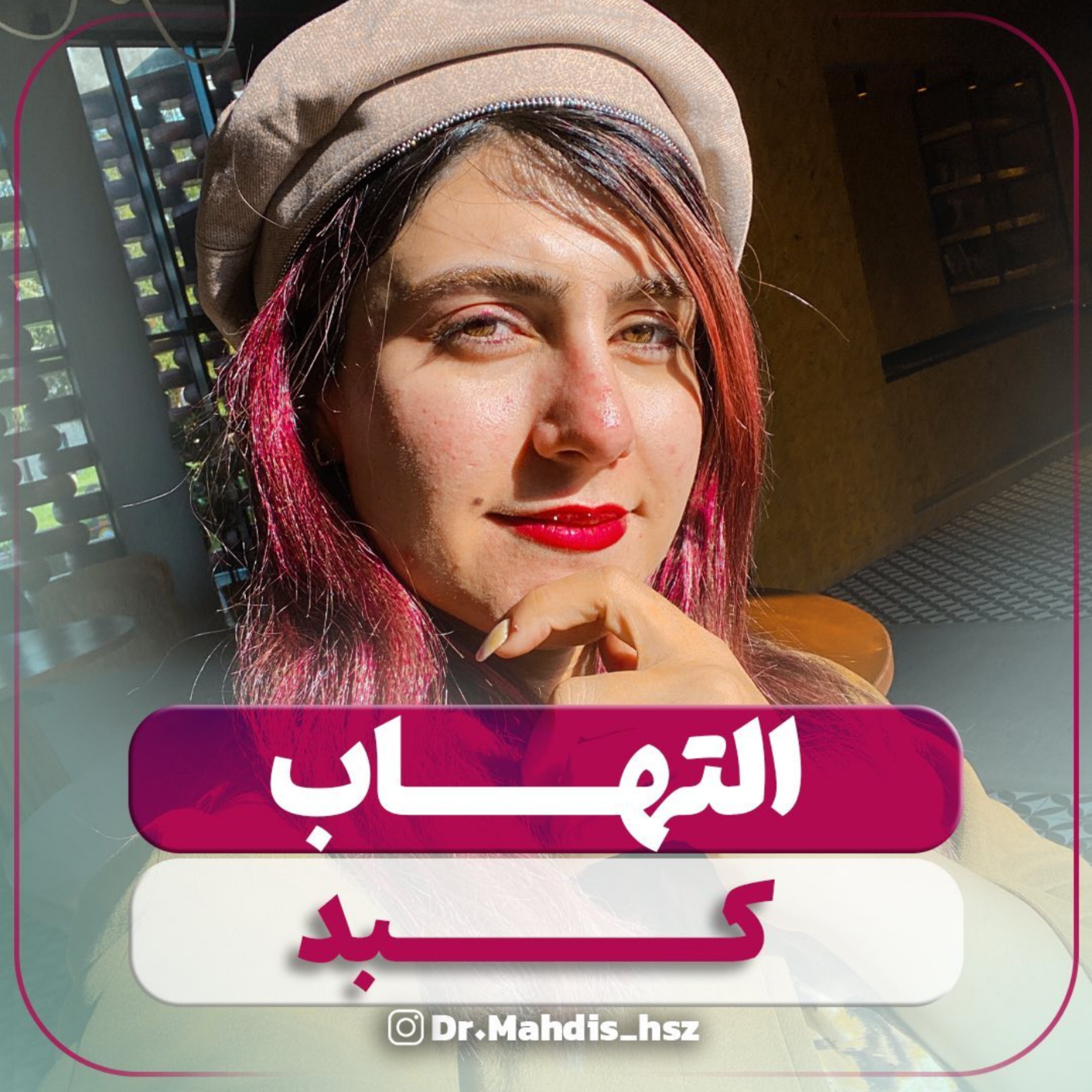 کاور التهاب کبدو تغذیه. دکتر مهدیس حسن زاده