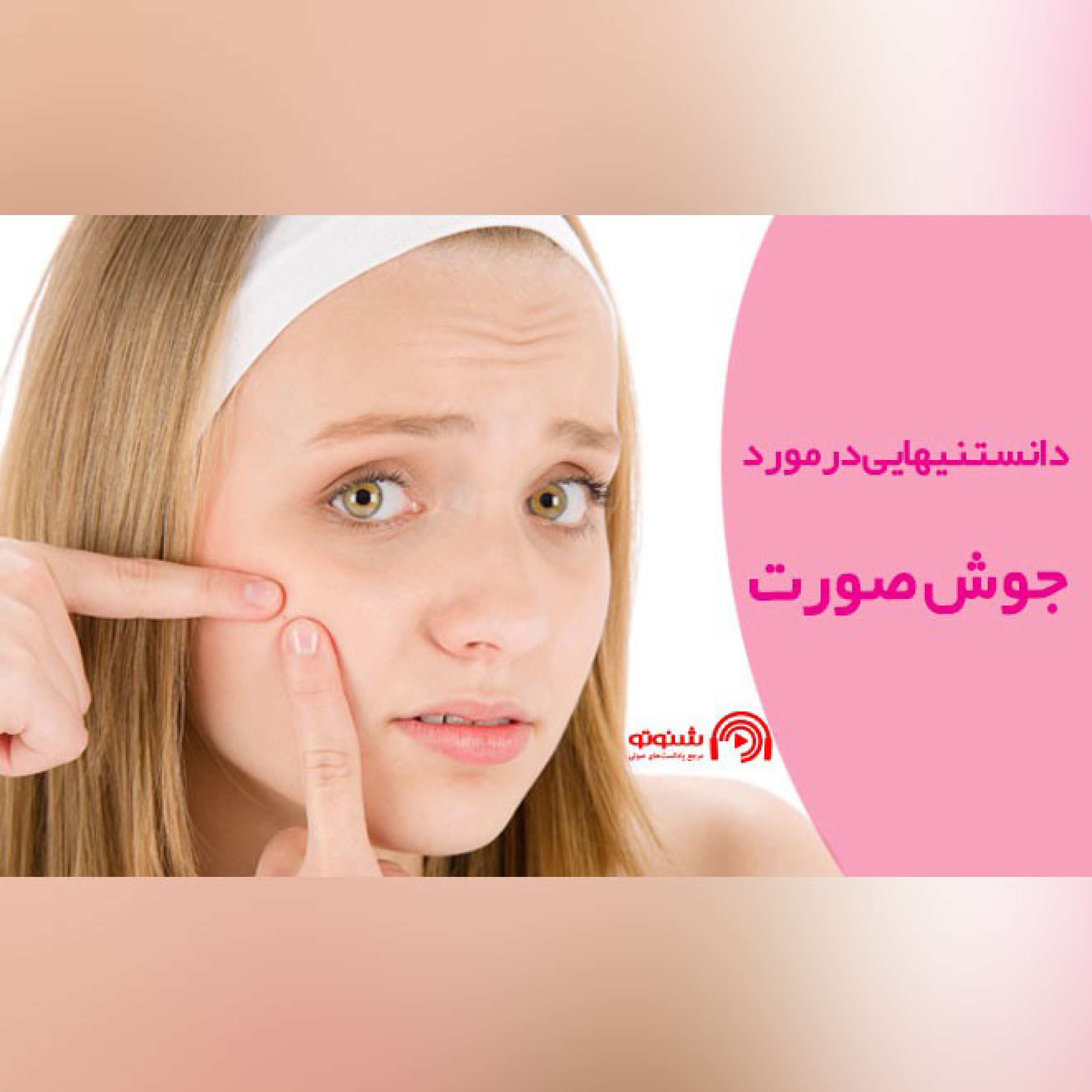 کاور دانستنیها در مورد جوش صورت