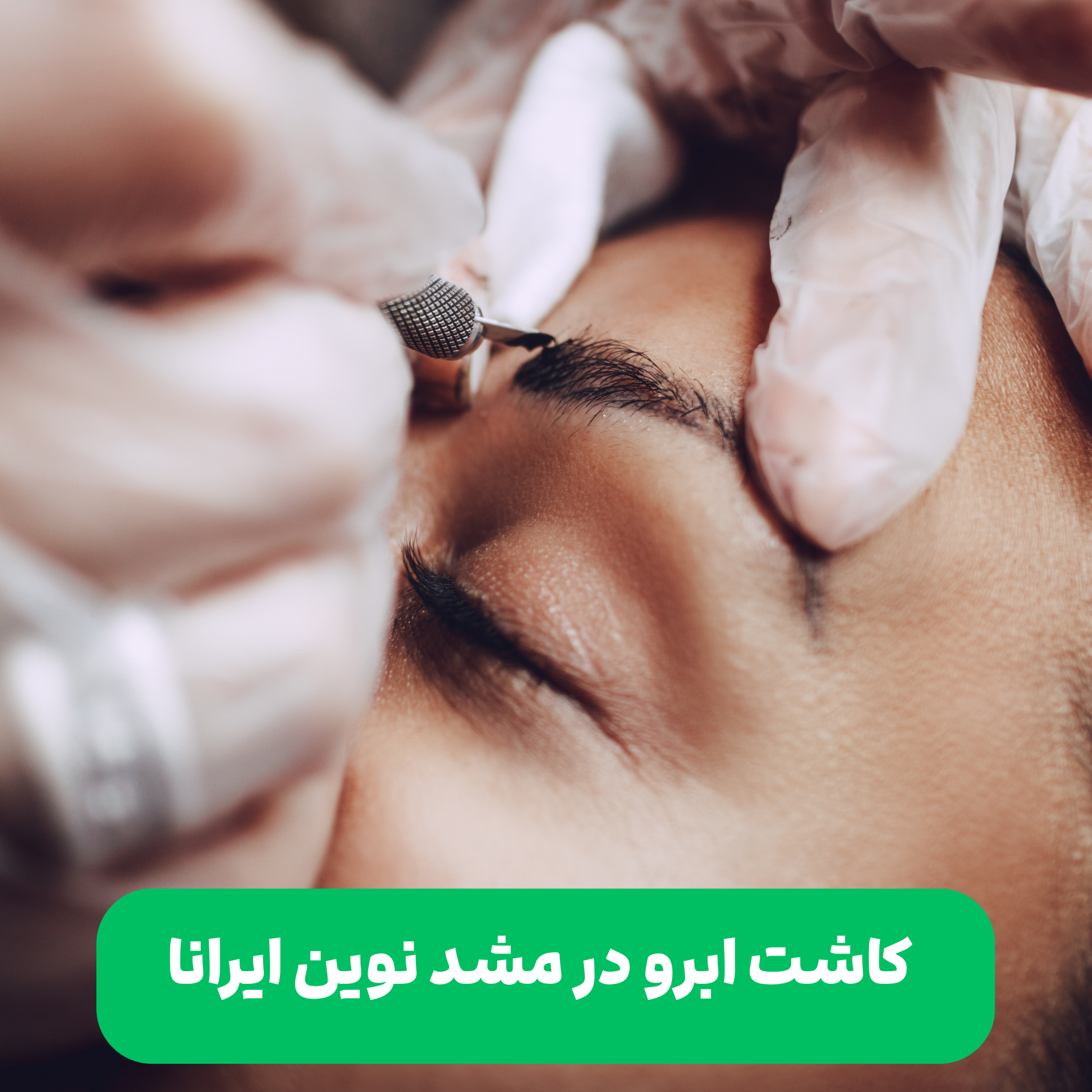 کاور پادکست کاشت ابرو در نوین ایرانا