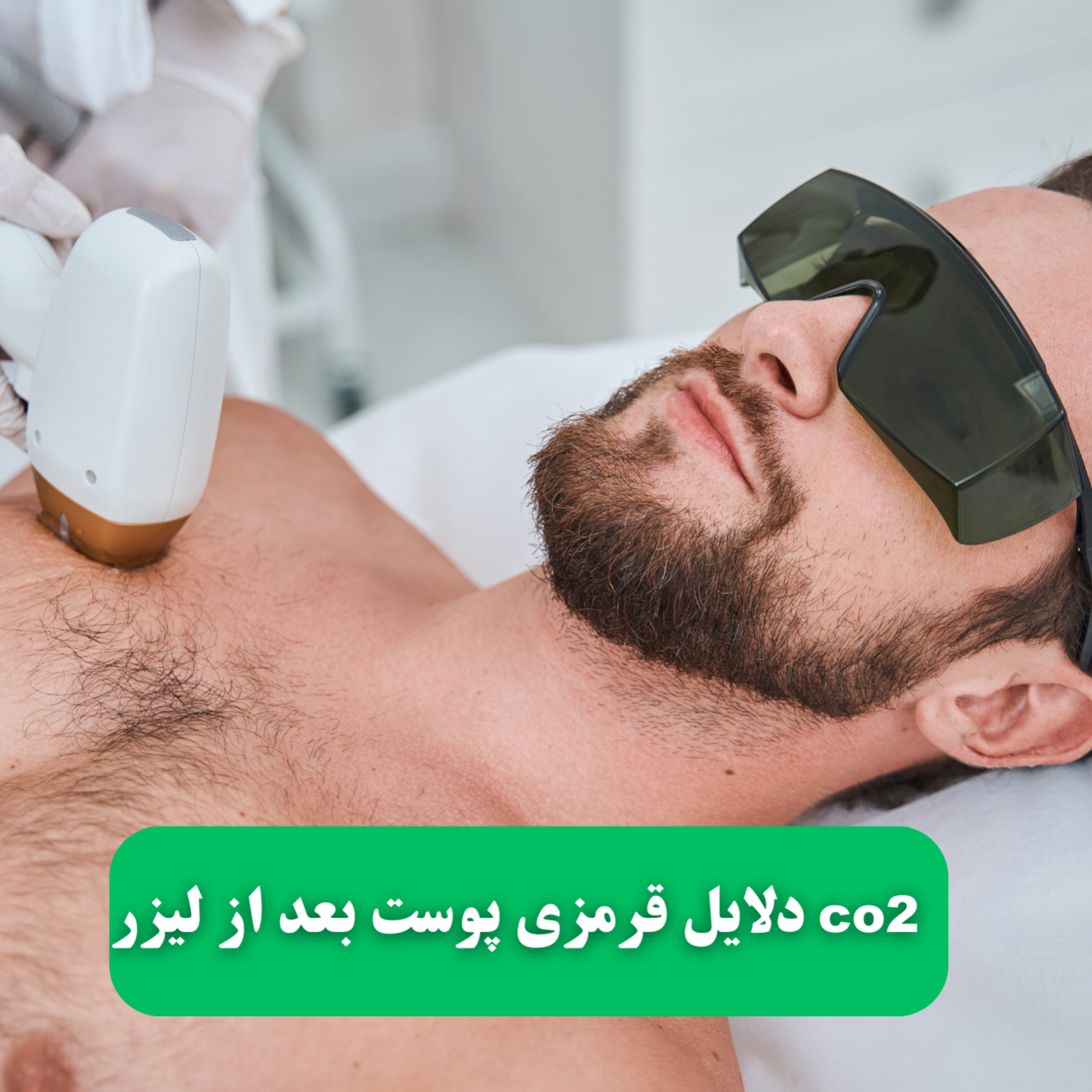 کاور دلایل قرمزی پوست بعد از لیزر co2