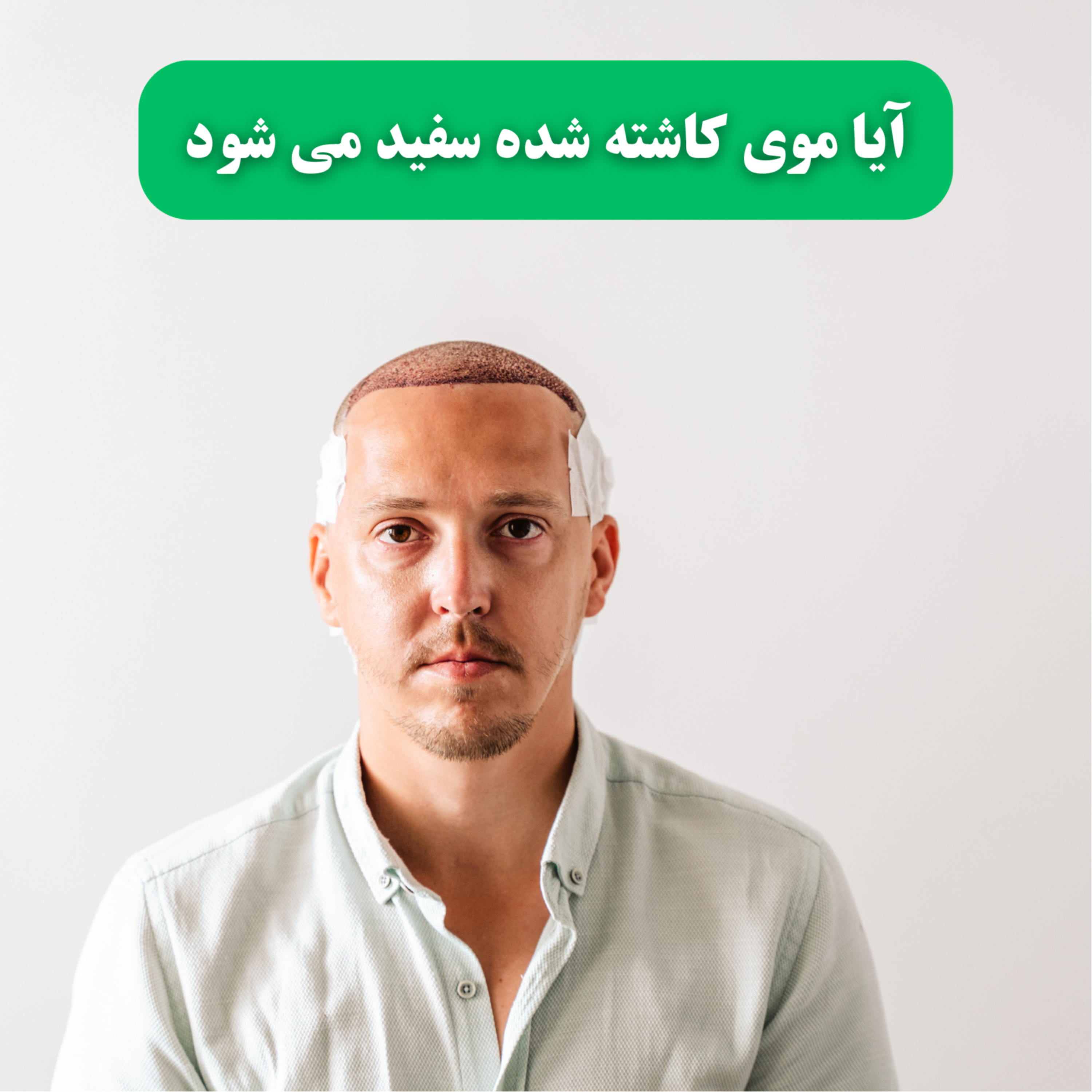 کاور آیا موی کاشته شده سفید می شود؟
