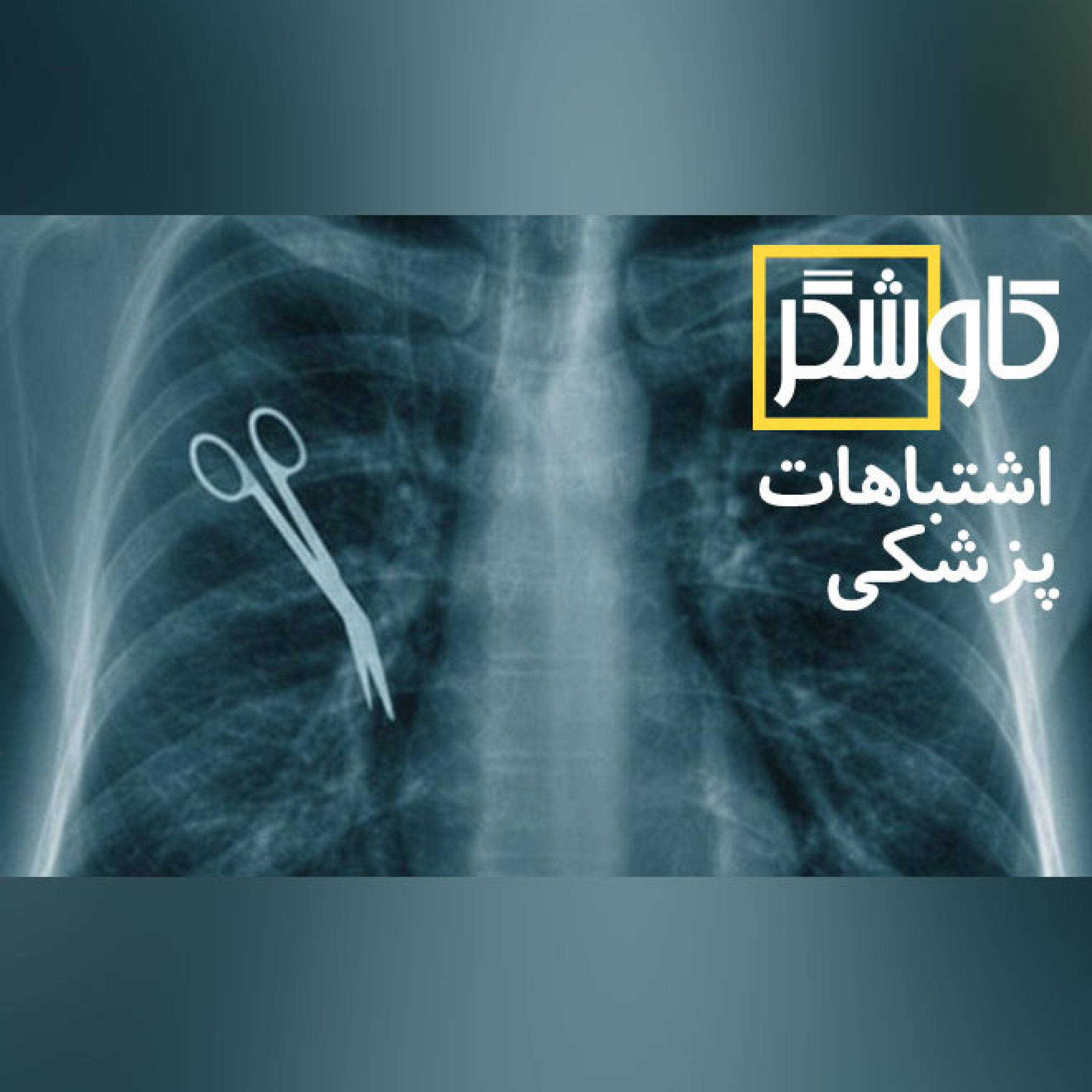 اشتباهات پزشکی