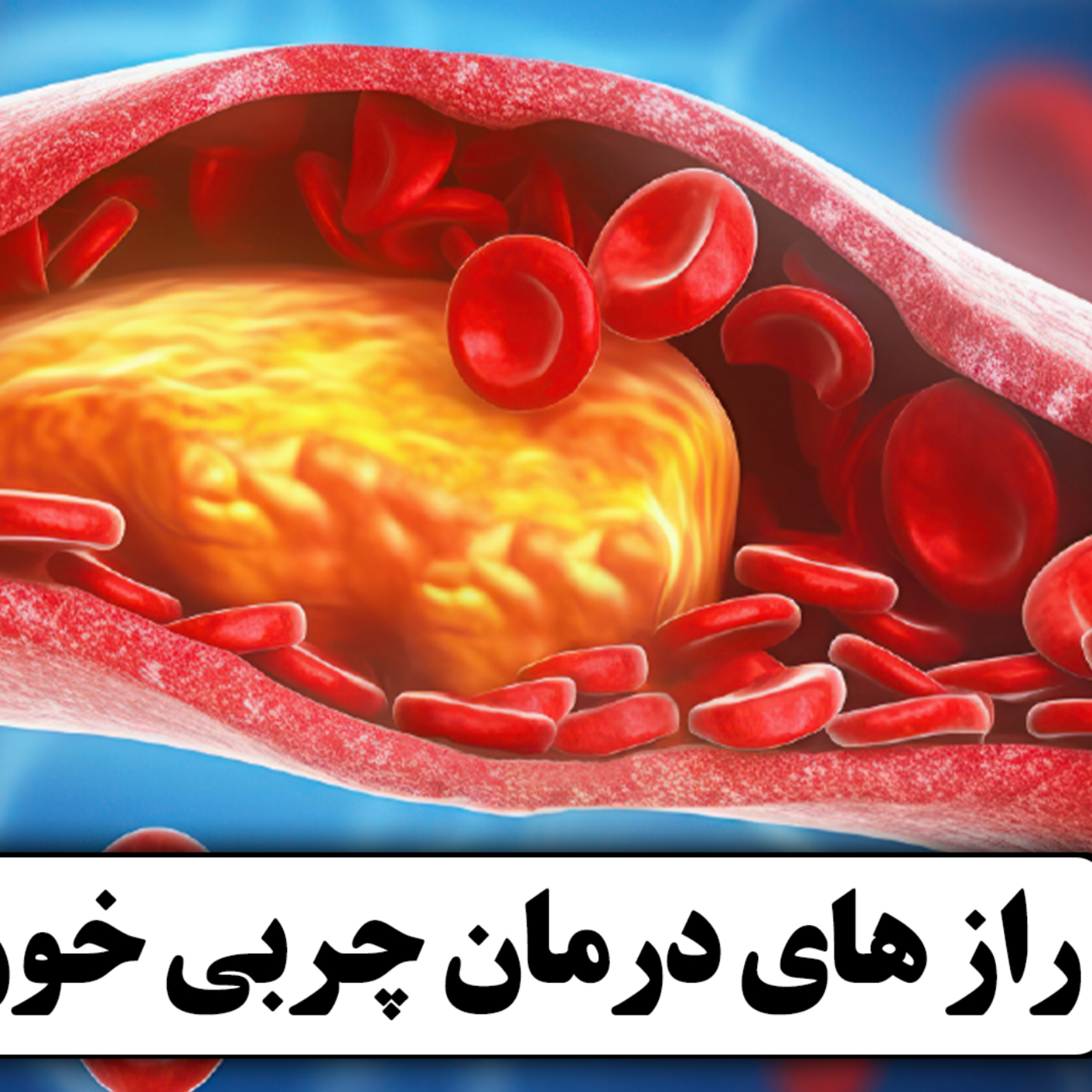 کاور راز های درمان چربی خون برای همیشه