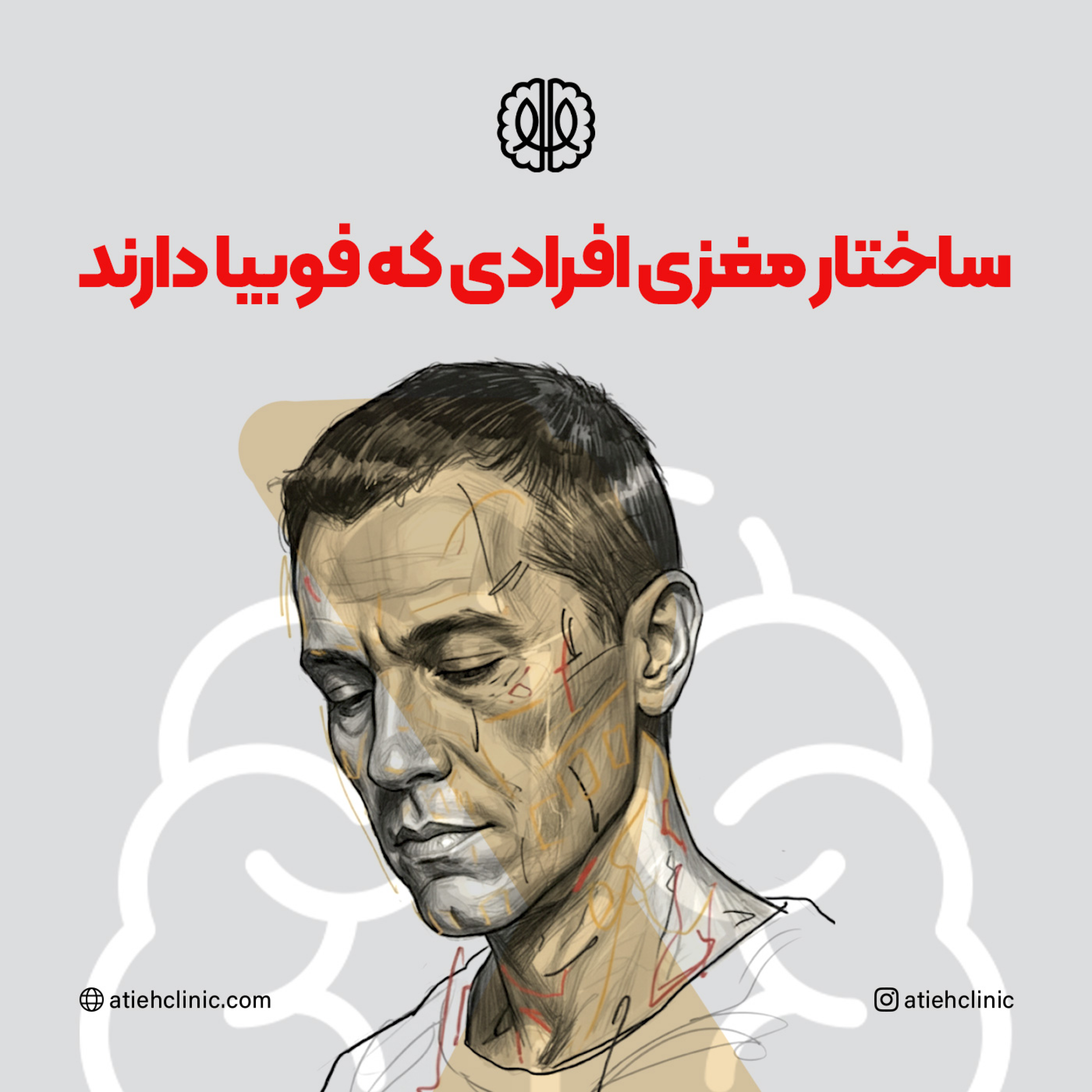 کاور ساختار مغزی افرادی که فوبیا دارند