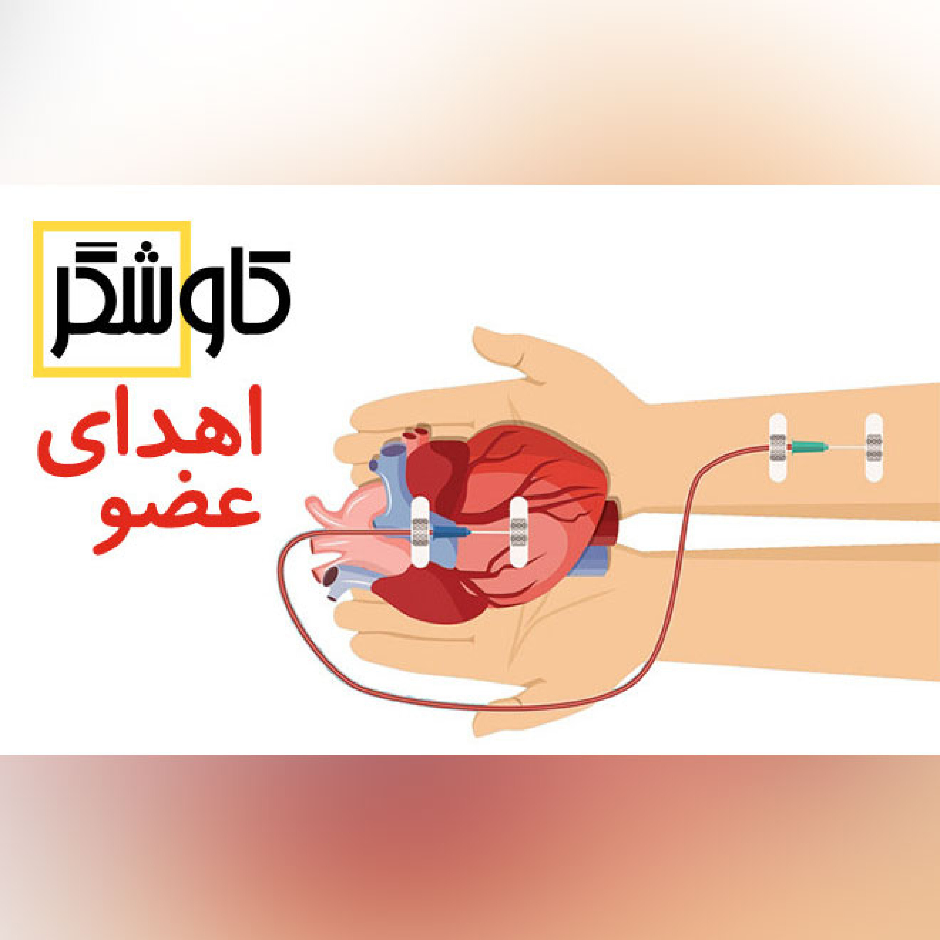 اهدای عضو