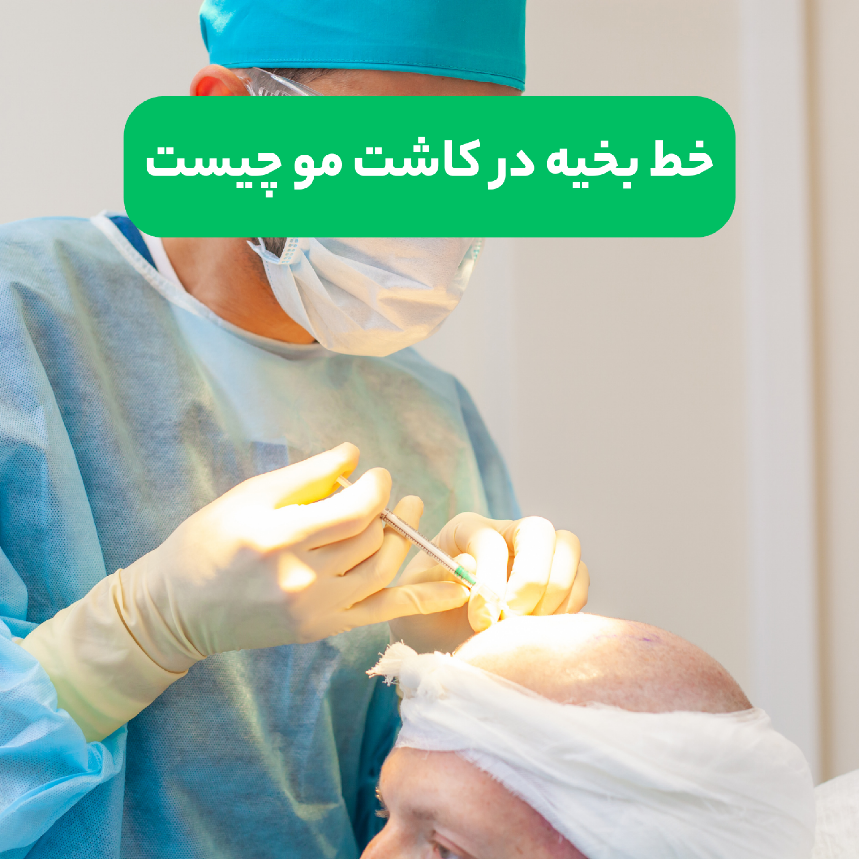 کاور خط بخیه در کاشت مو چیست