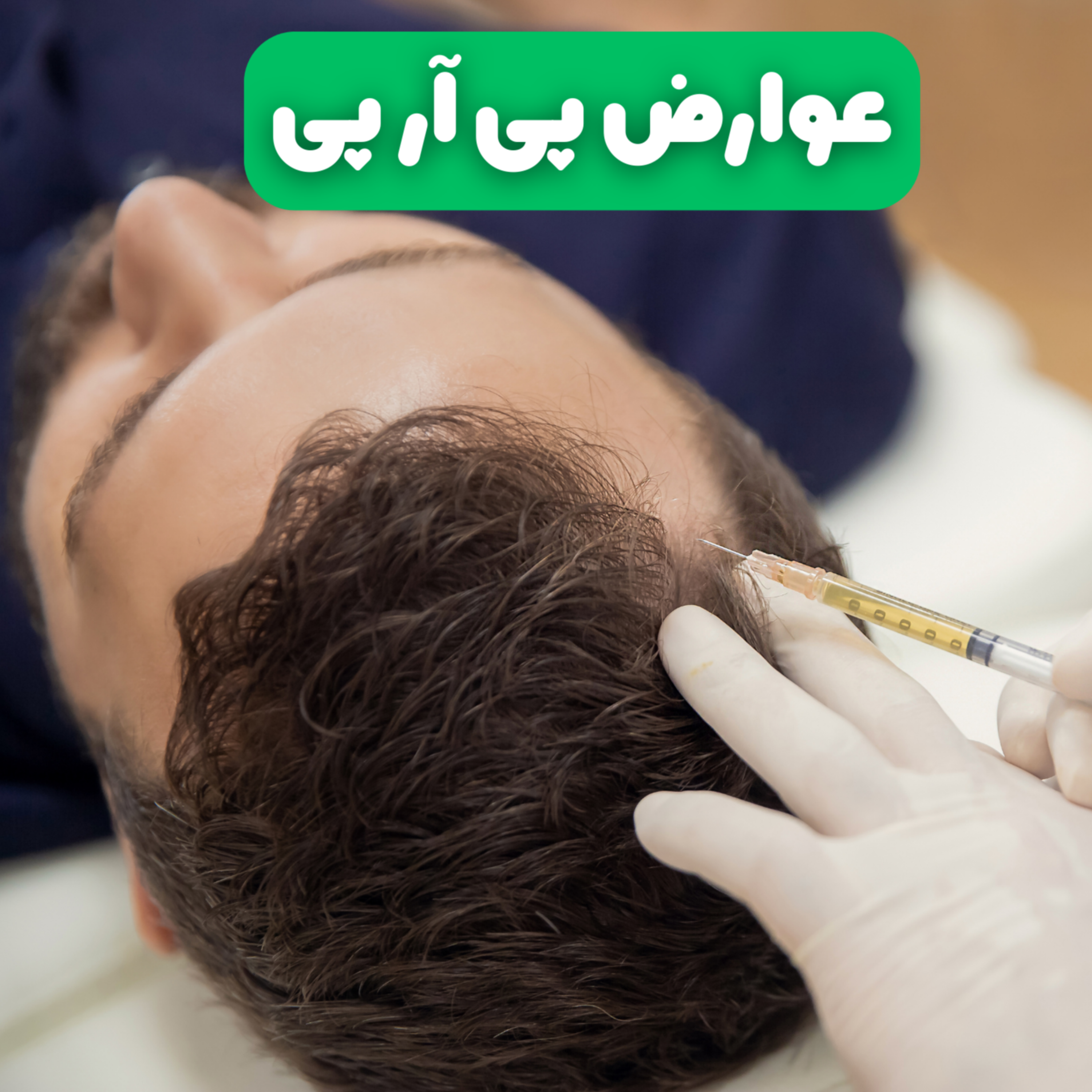 کاور عوارض پی آر پی چیست