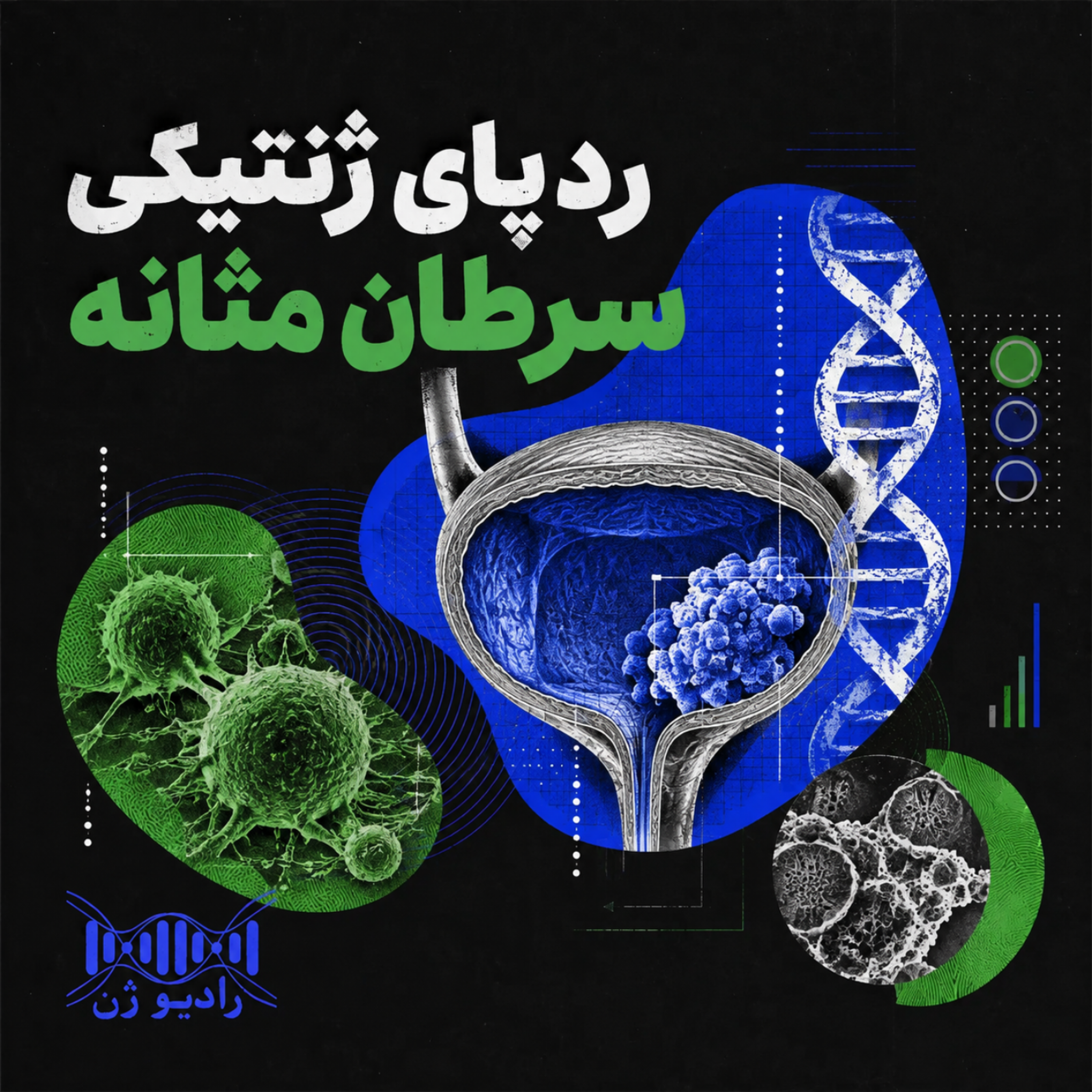 کاور ردپای ژنتیکی سرطان مثانه