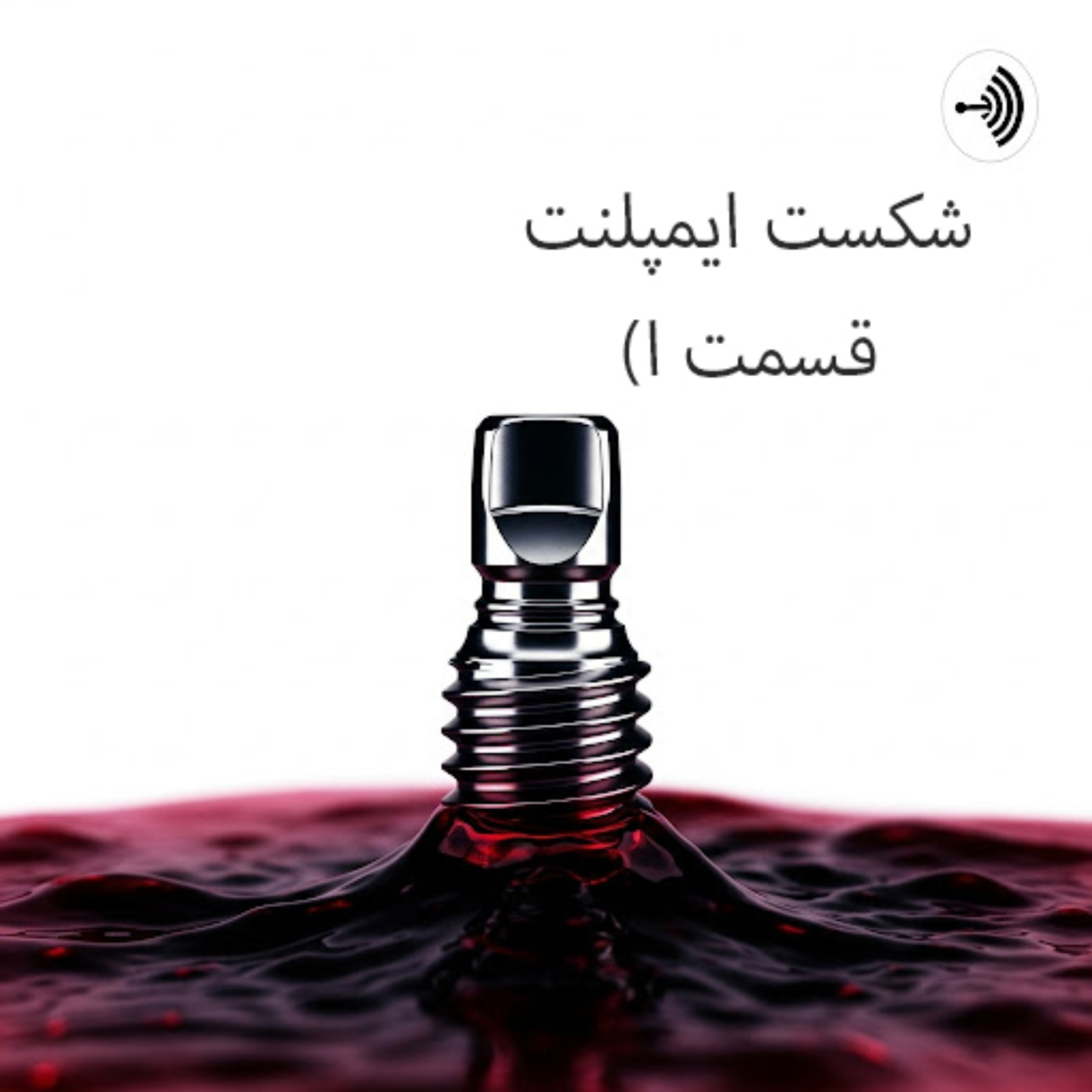 کاور شکست ایمپلنت: چرا اتفاق می افتد و چگونه می توان از آن جلوگیری کرد؟ (قسمت اول)