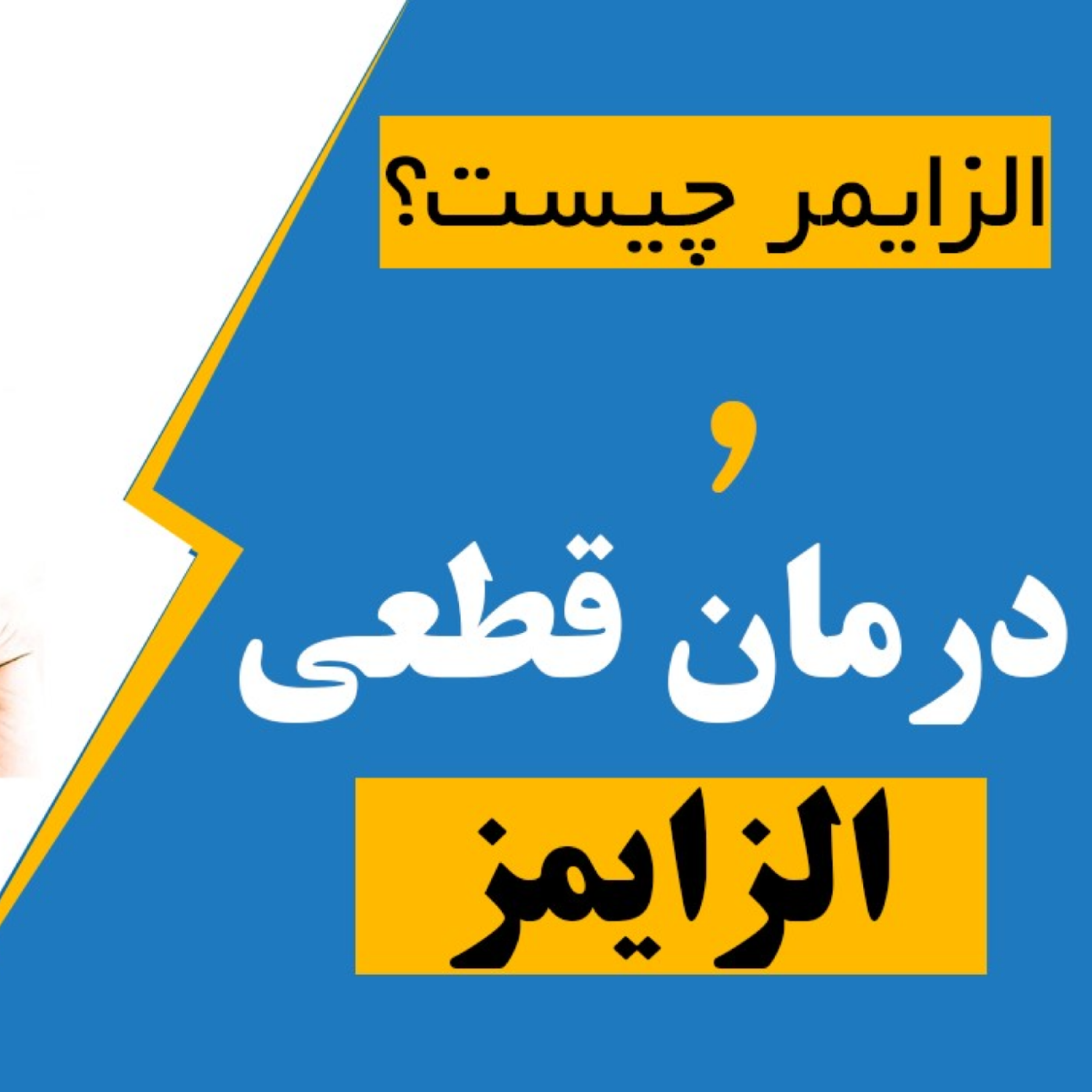 کاور درمان آلزایمر