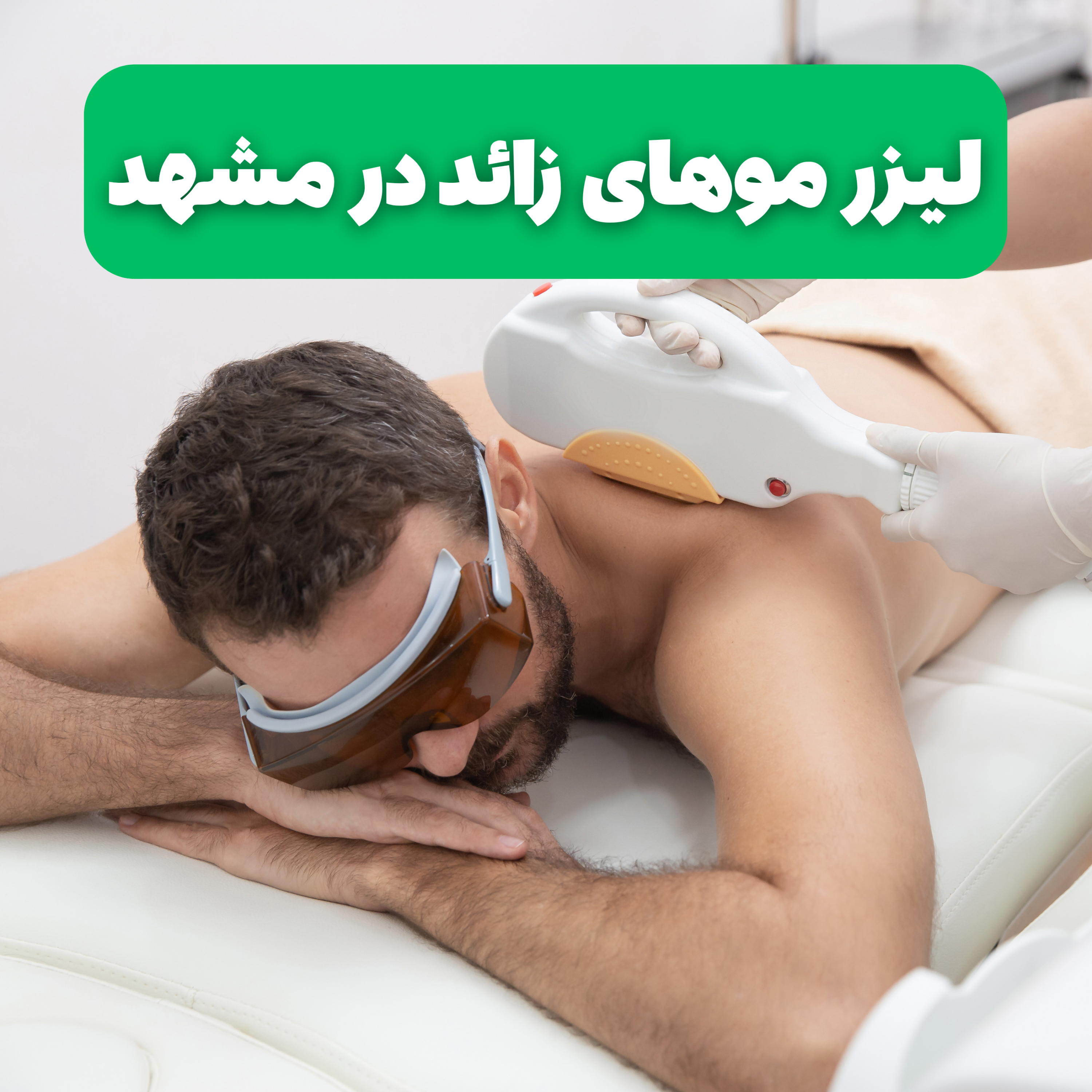 کاور لیزر موی زائد در مشهد