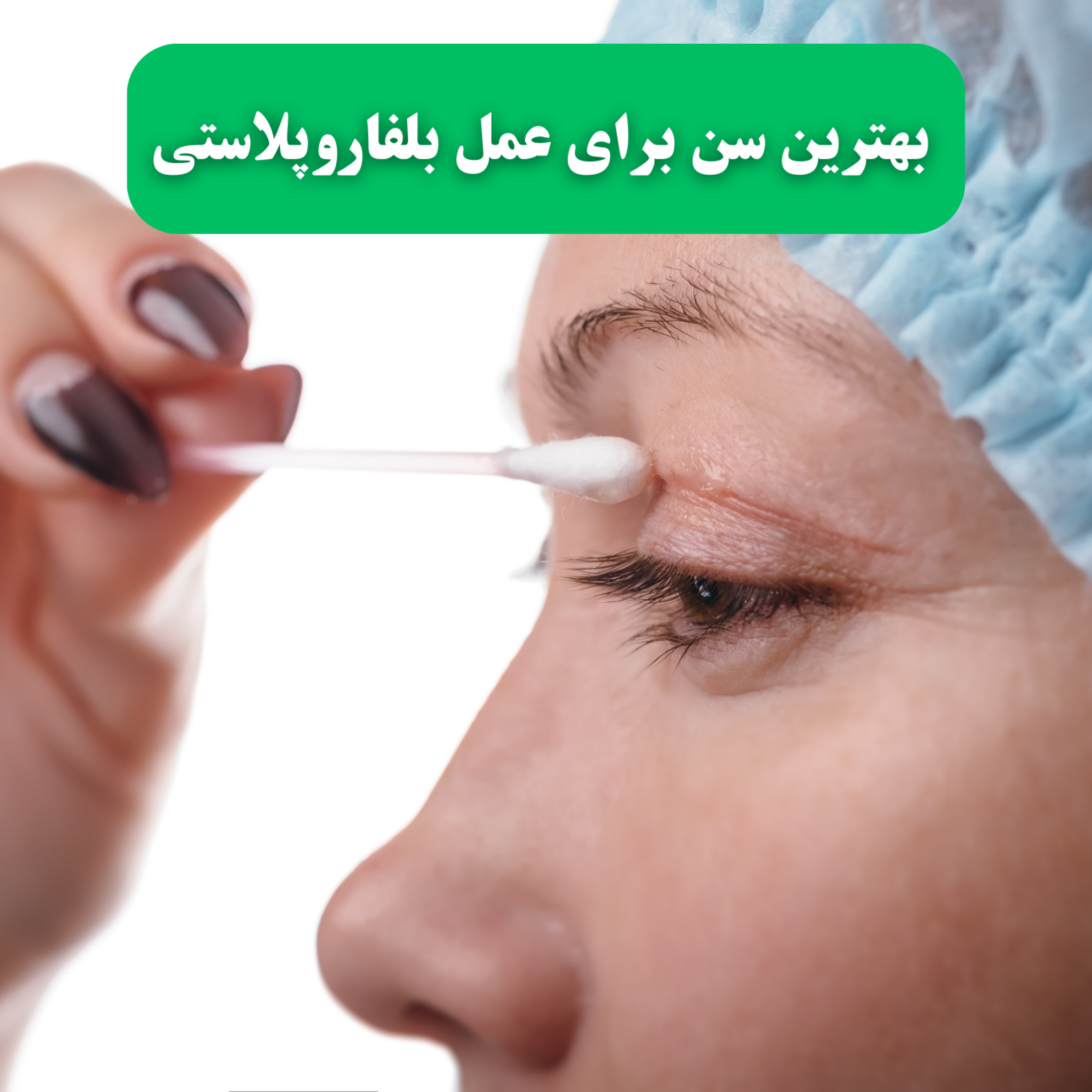 کاور بهترین سن برای عمل بلفاروپلاستی