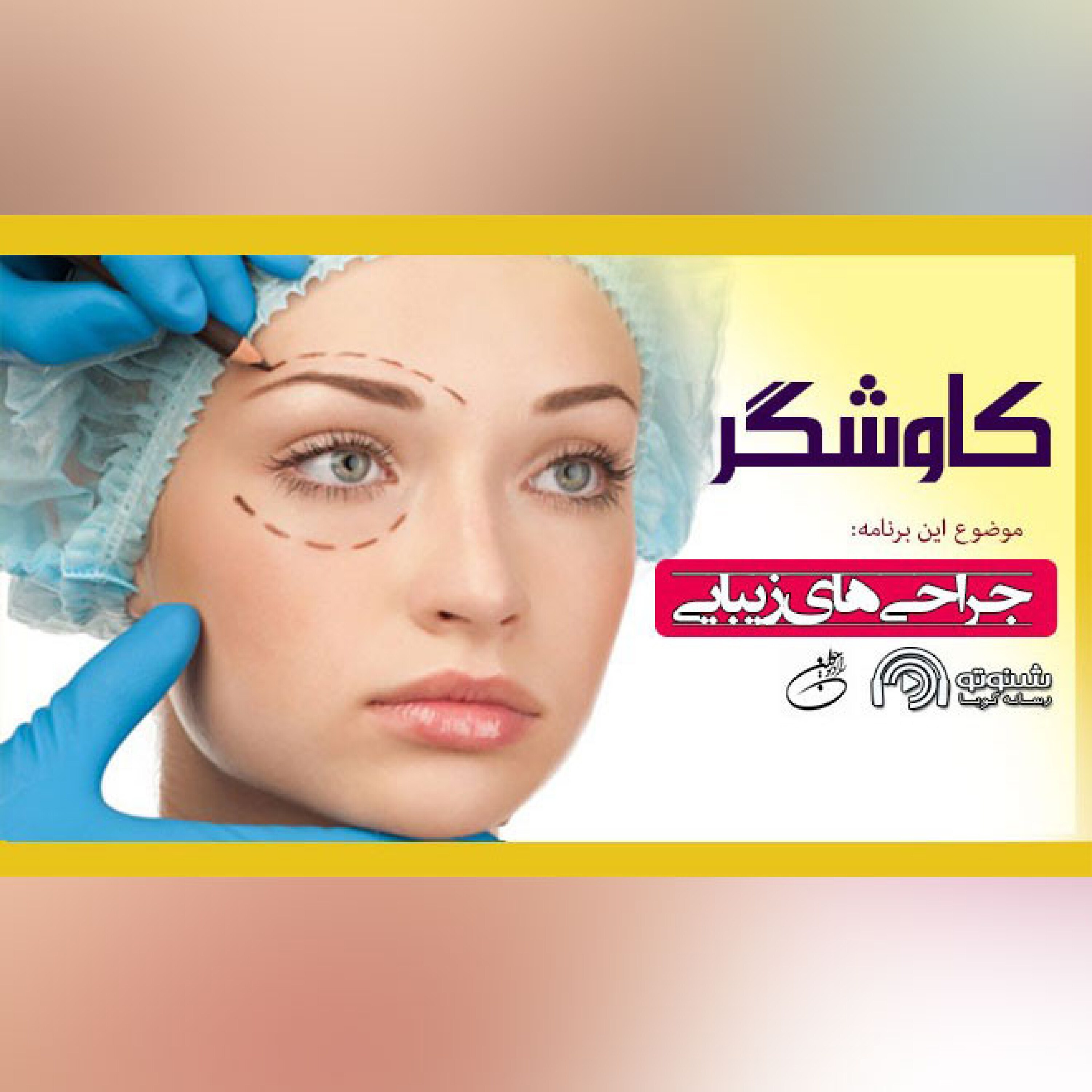 کاوشگر (جراحی زیبایی)