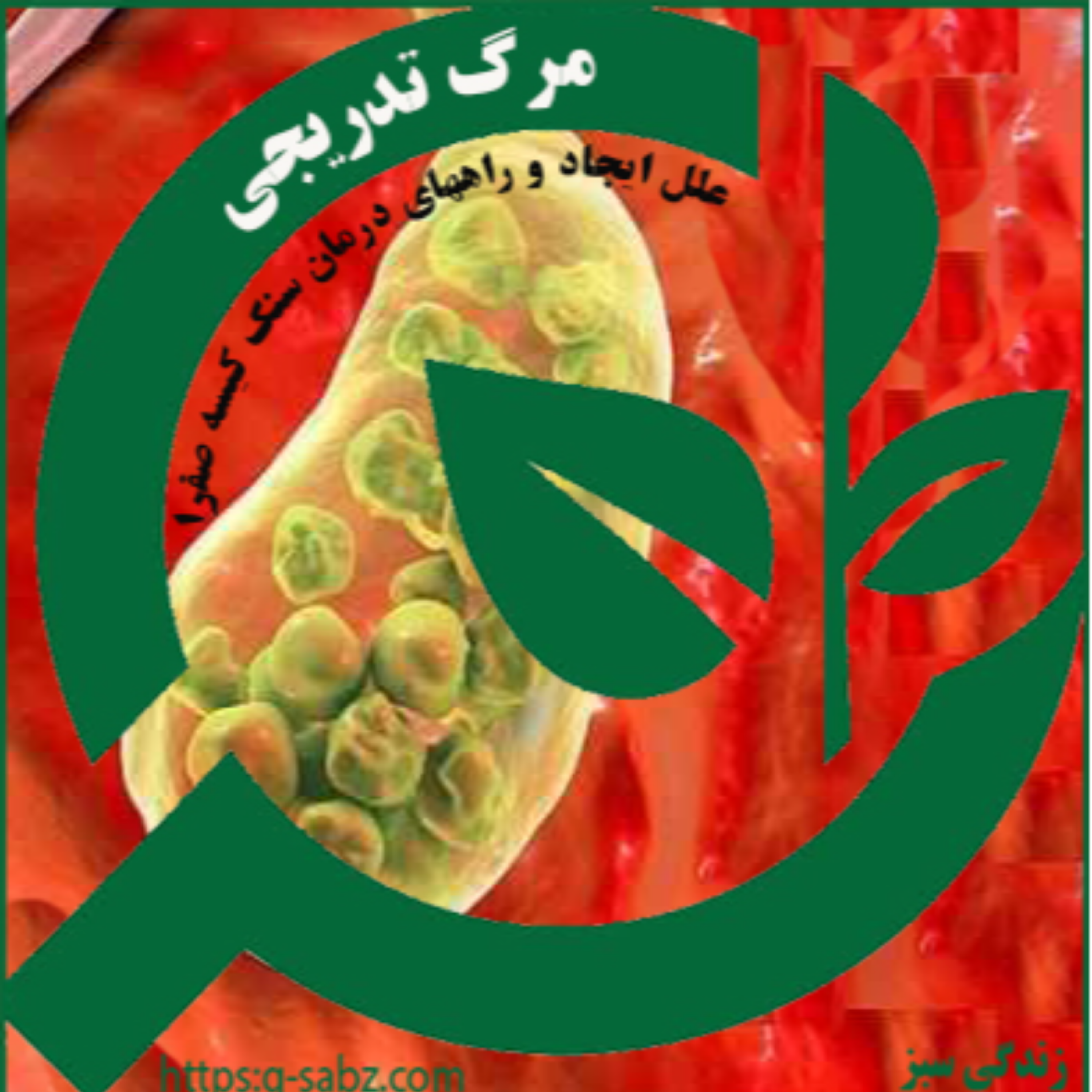 کاور مرگ تدریجی (سنگ کیسه ی صفرا)