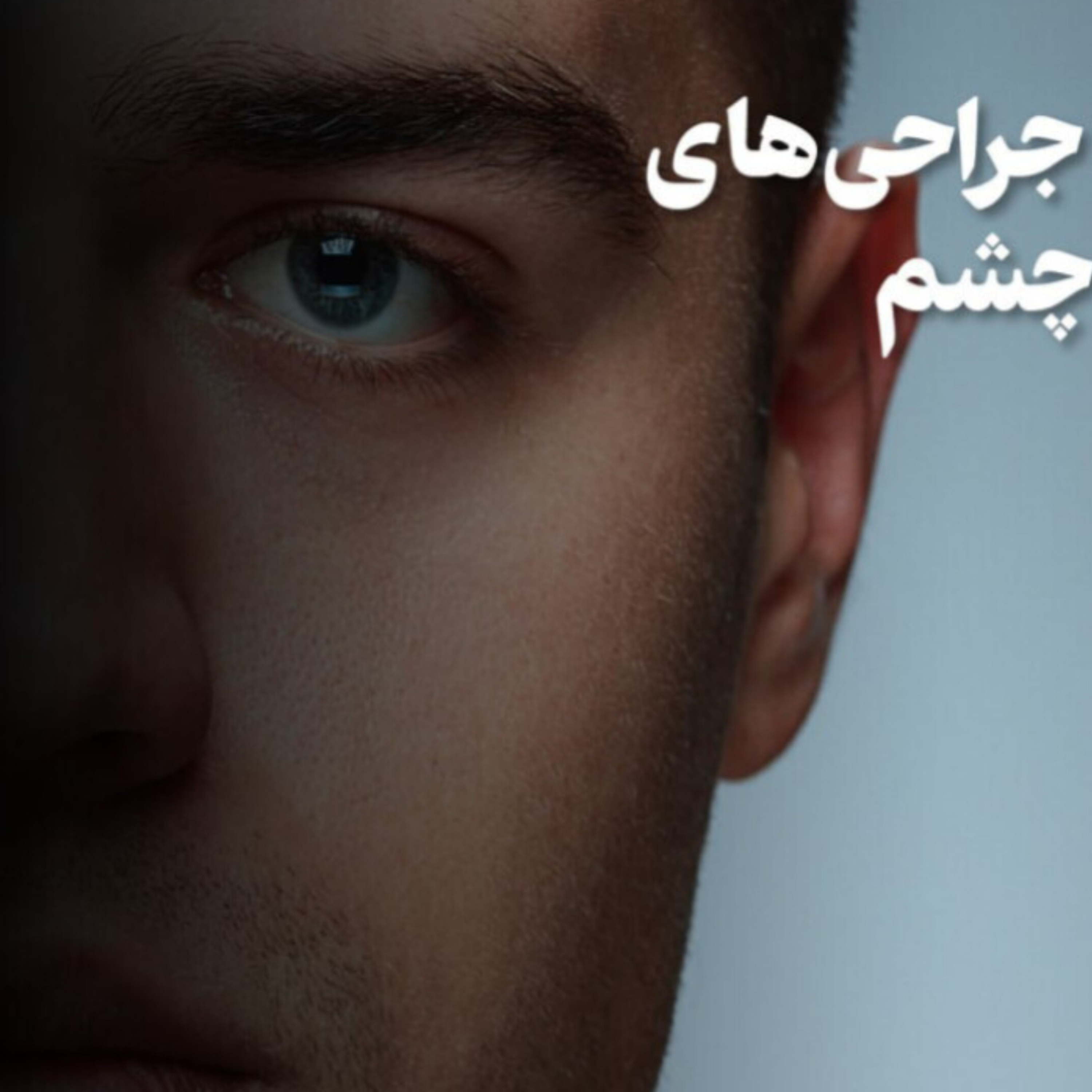 کاور پشت پرده جراحی های تغییر رنگ چشم