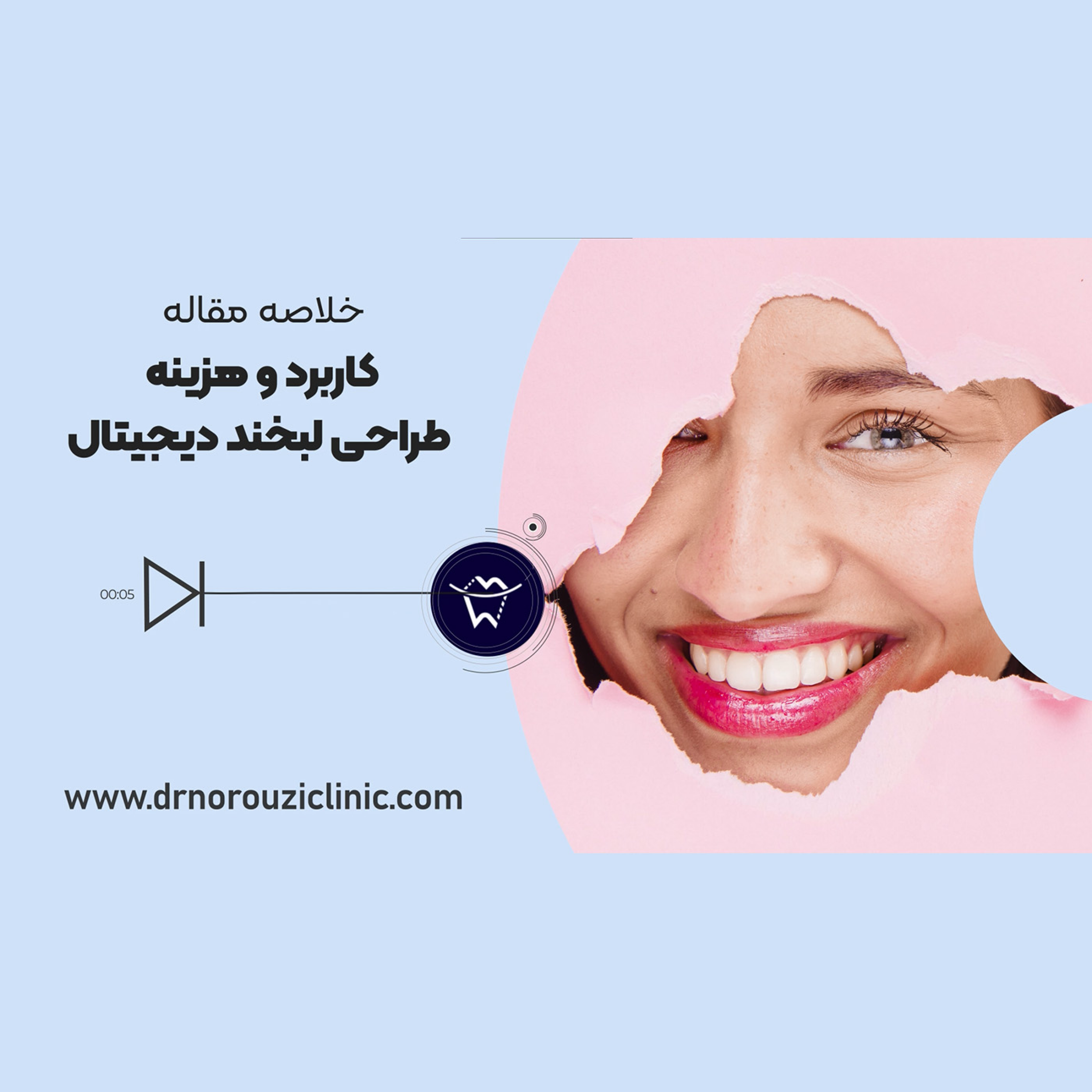 کاور کاربرد و هزینه طراحی لبخند دیجیتال