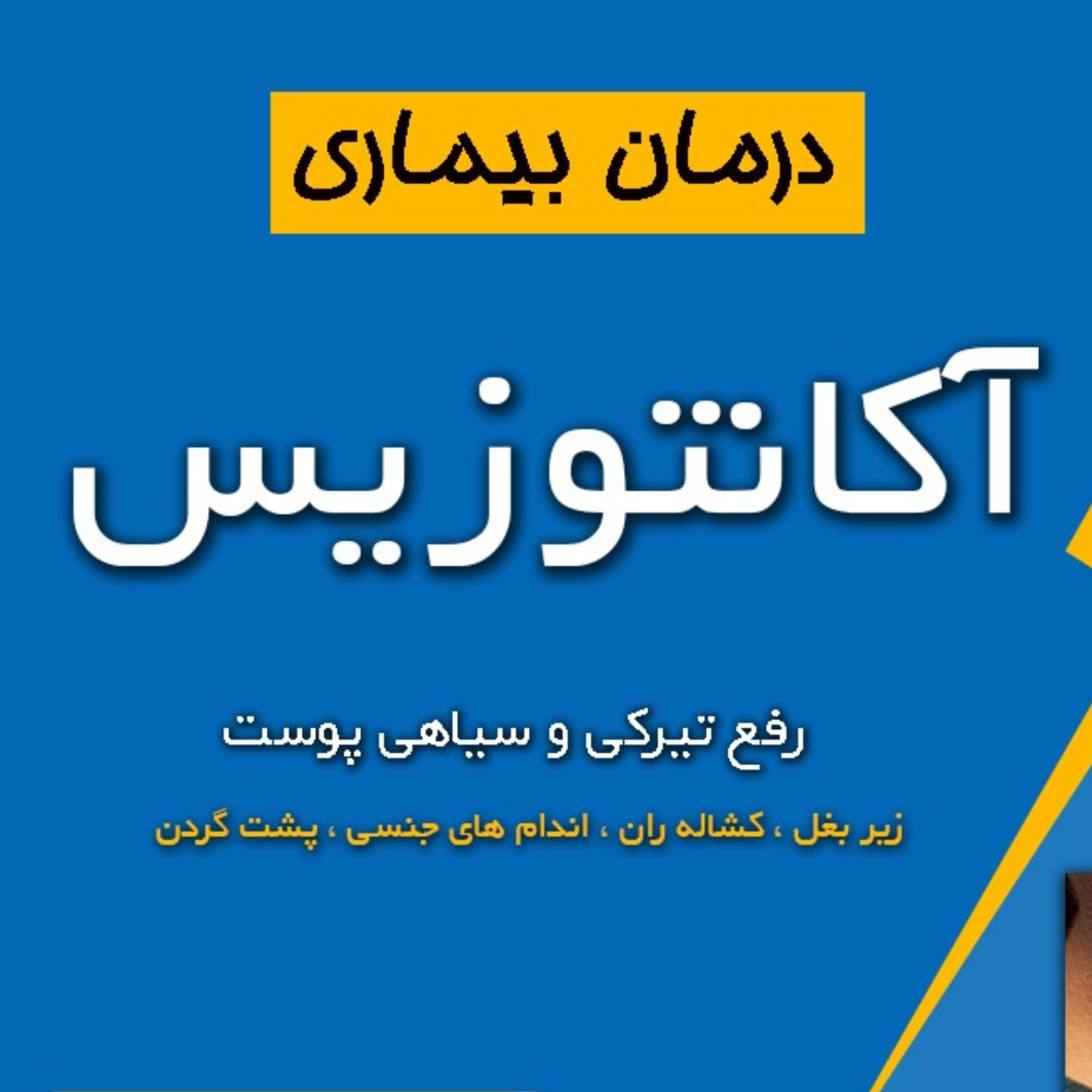 کاور رفع تیرگی کشاله ران و ناحیه تناسلی