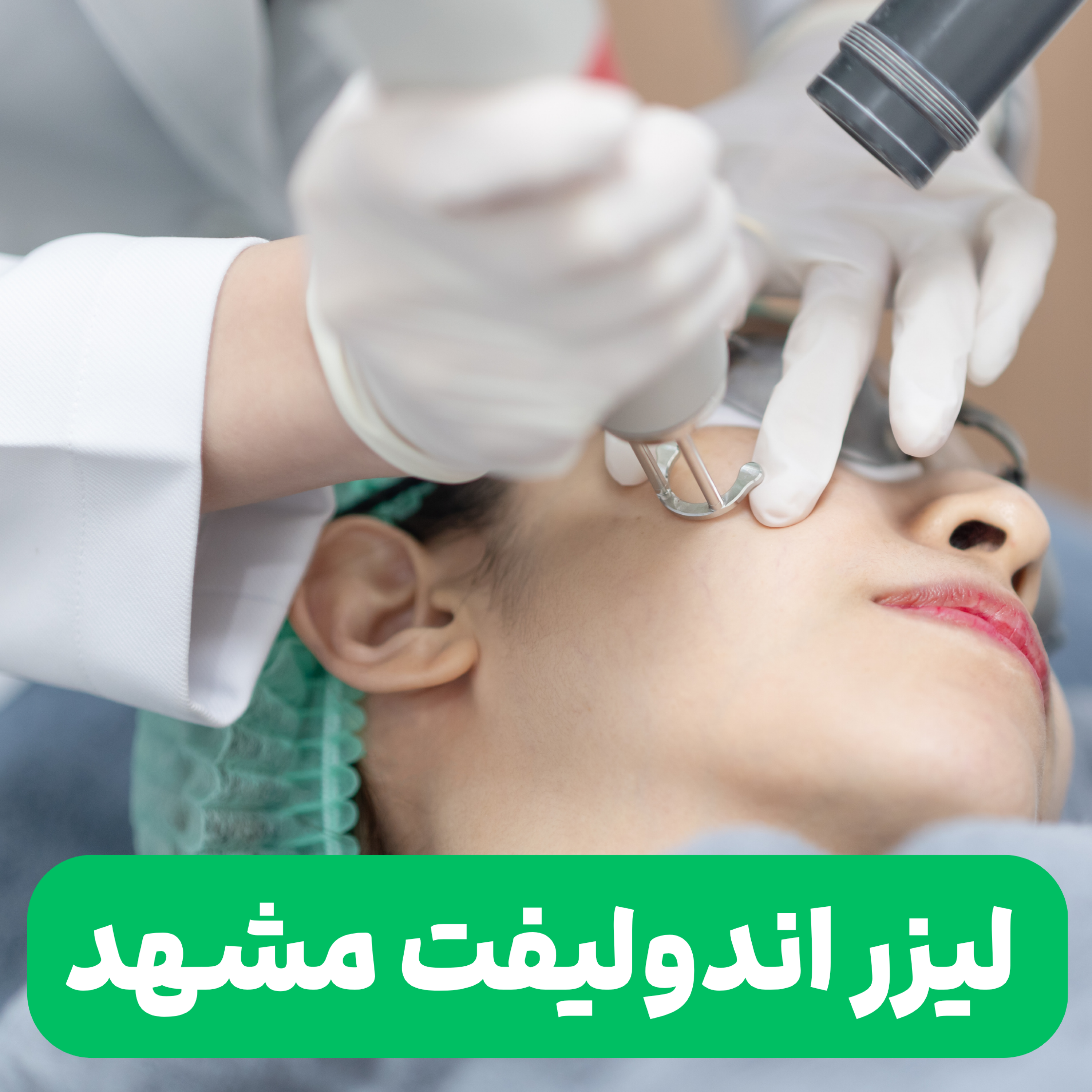 کاور لیزر اندولیفت پارت ۲