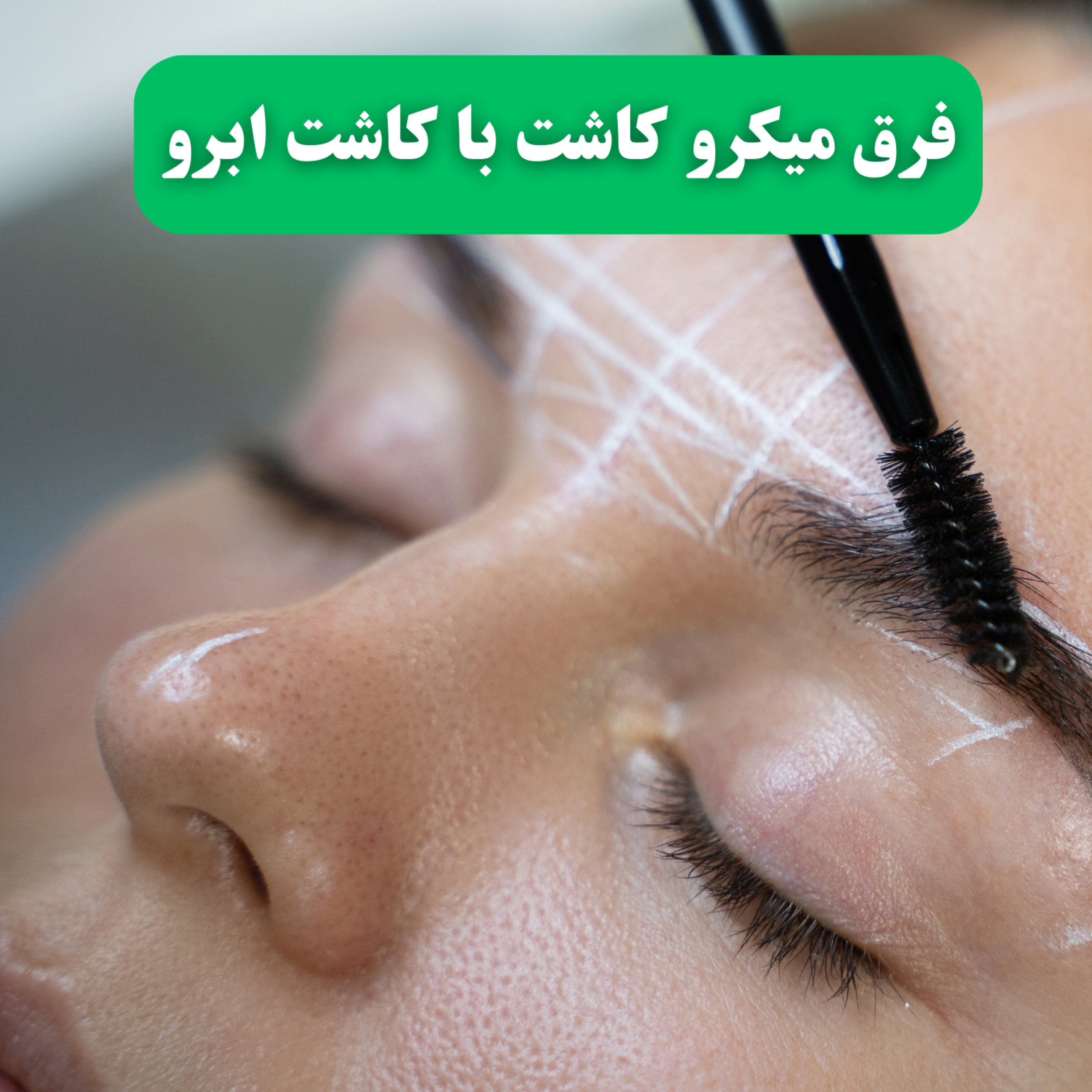 کاور فرق میکرو کاشت با کاشت ابرو