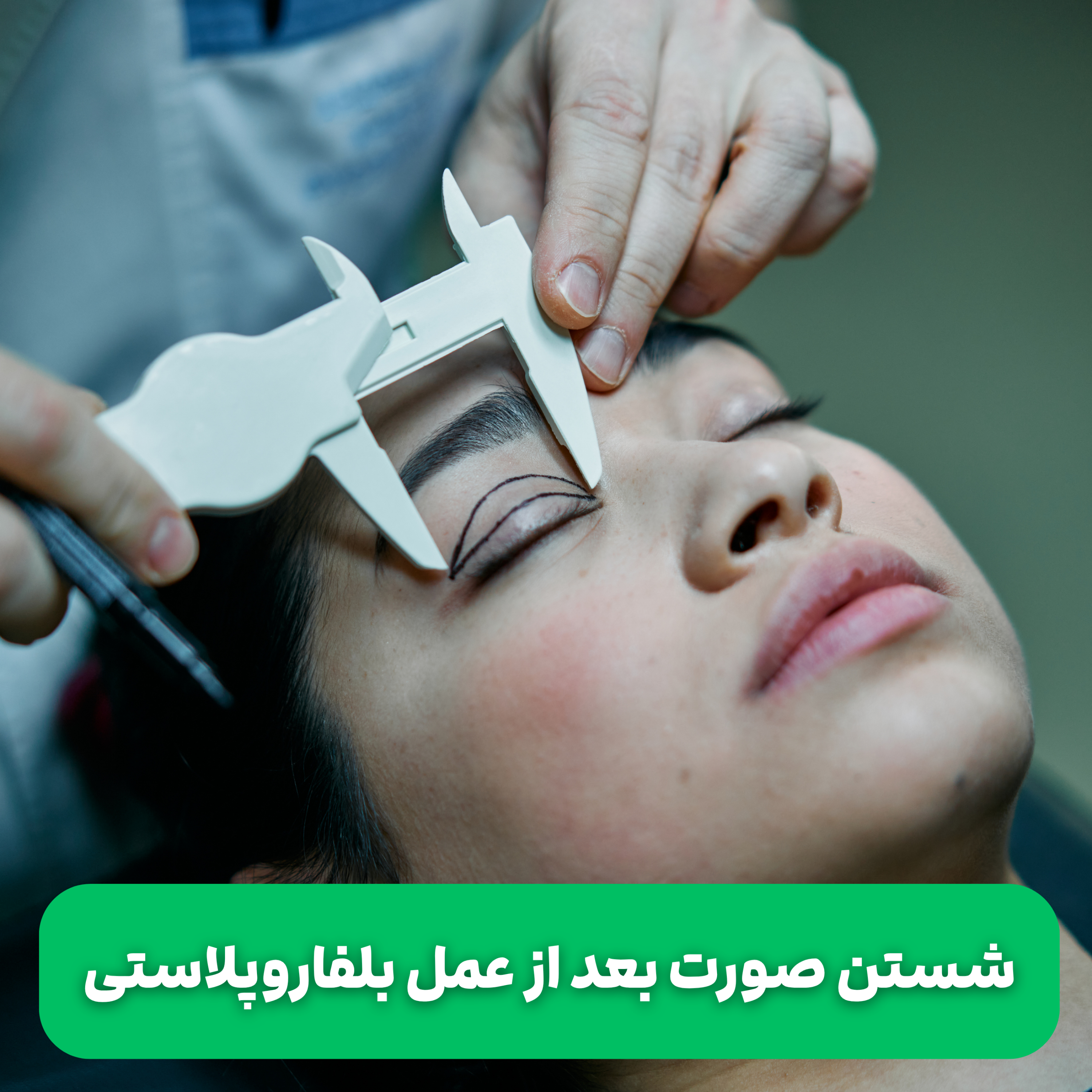 کاور شستن صورت بعد از عمل بلفاروپلاستی