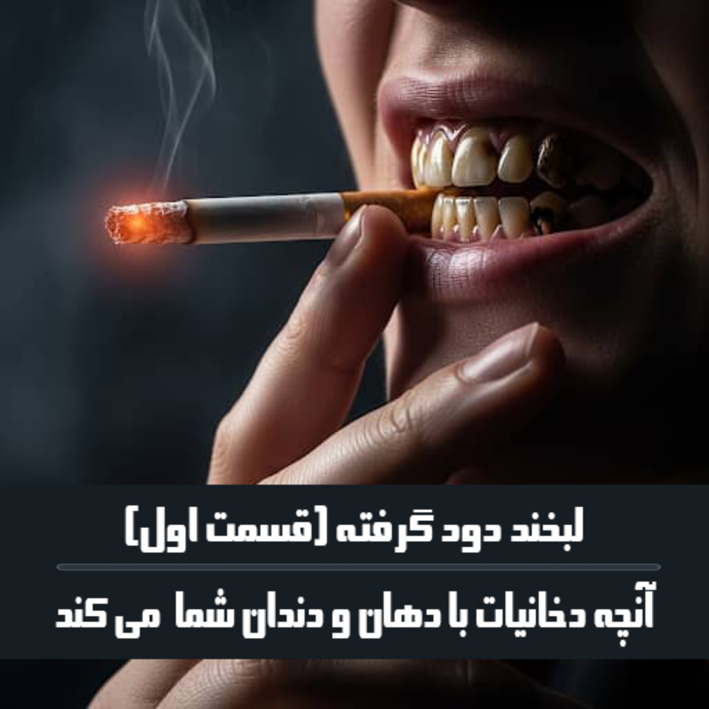 کاور لبخند دود گرفته: آنچه دخانیات با دهان و دندان شما می کند.(قسمت اول)