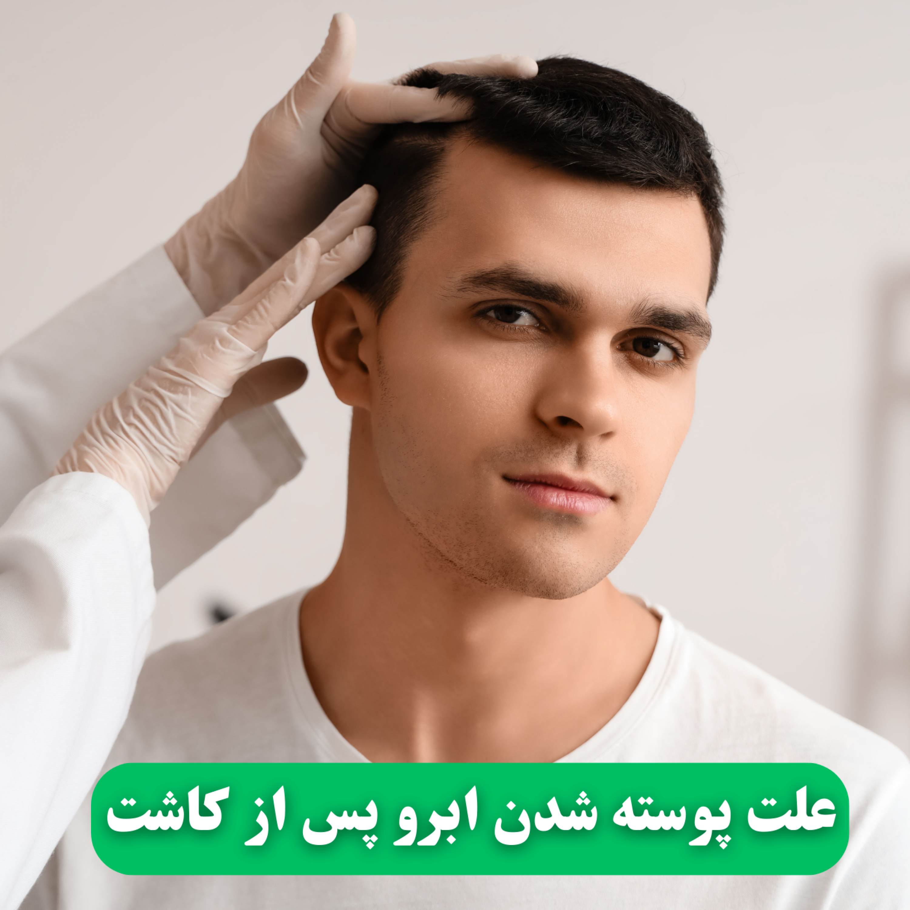 کاور علت پوسته شدن ابرو پس از کاشت