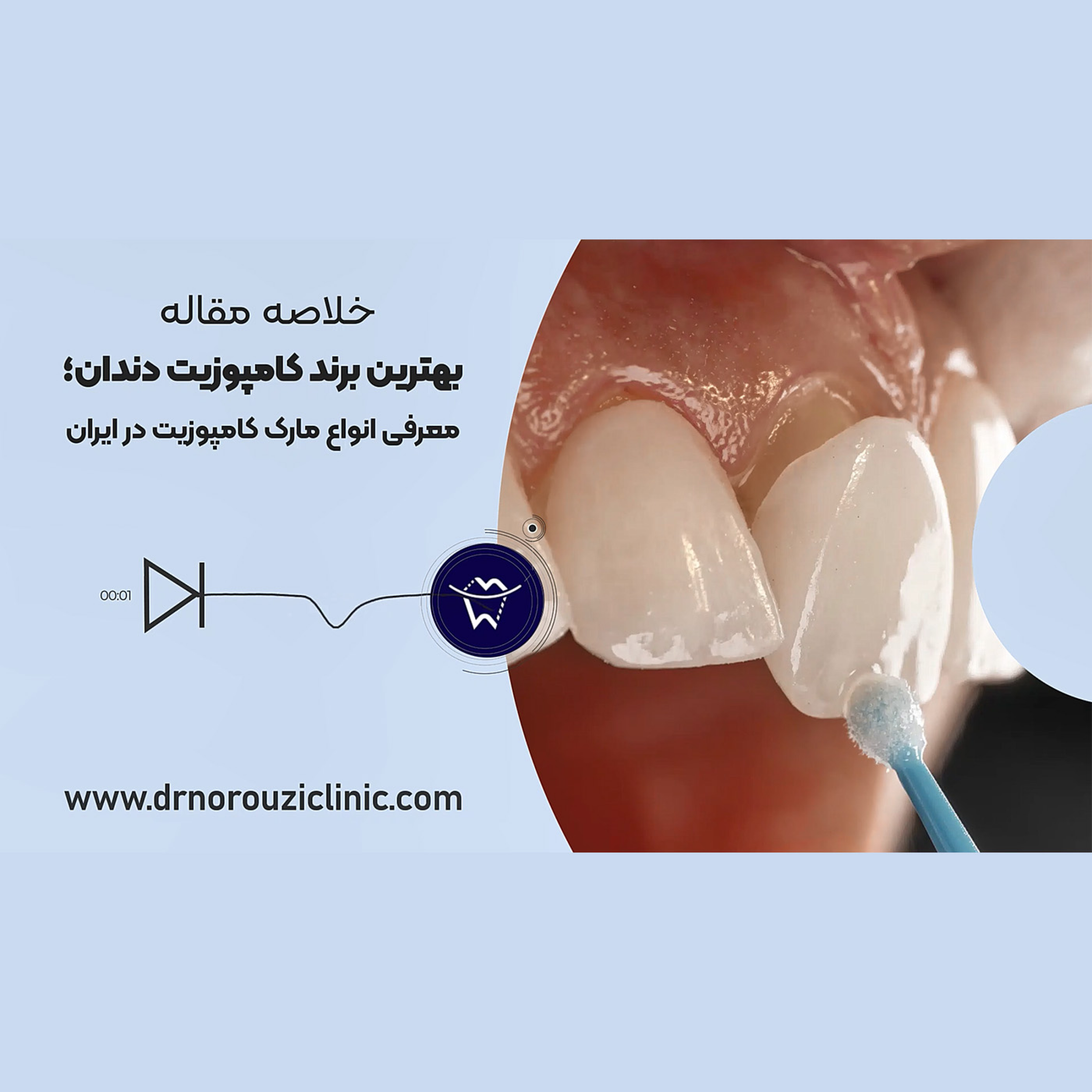 کاور بهترین برند کامپوزیت دندان