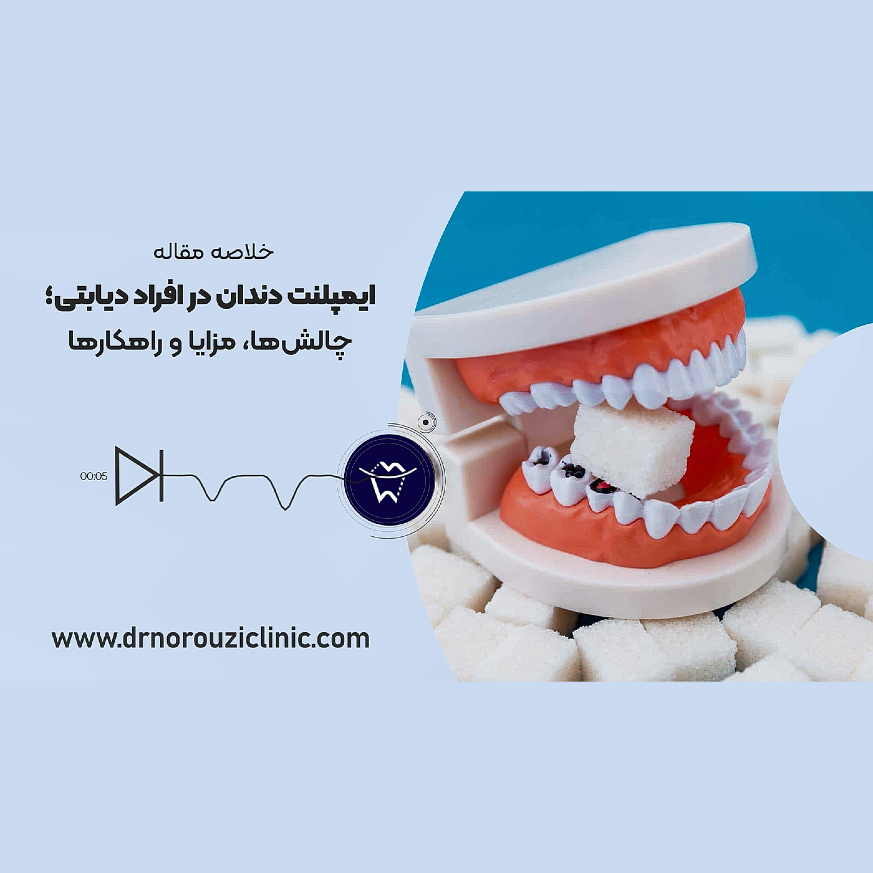کاور ایمپلنت دندان افراد دیابتی