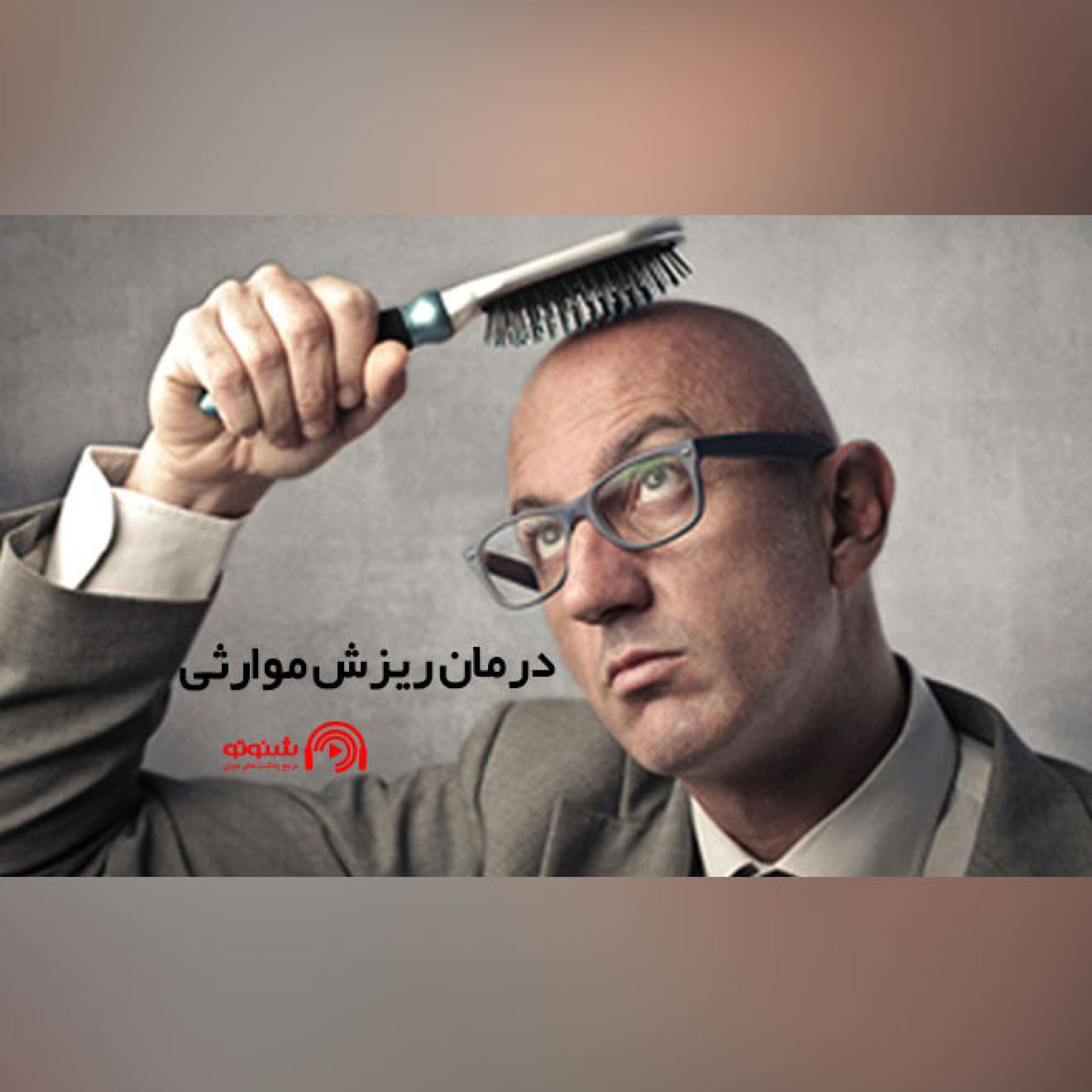 کاور درمان ریزش موی ارثی