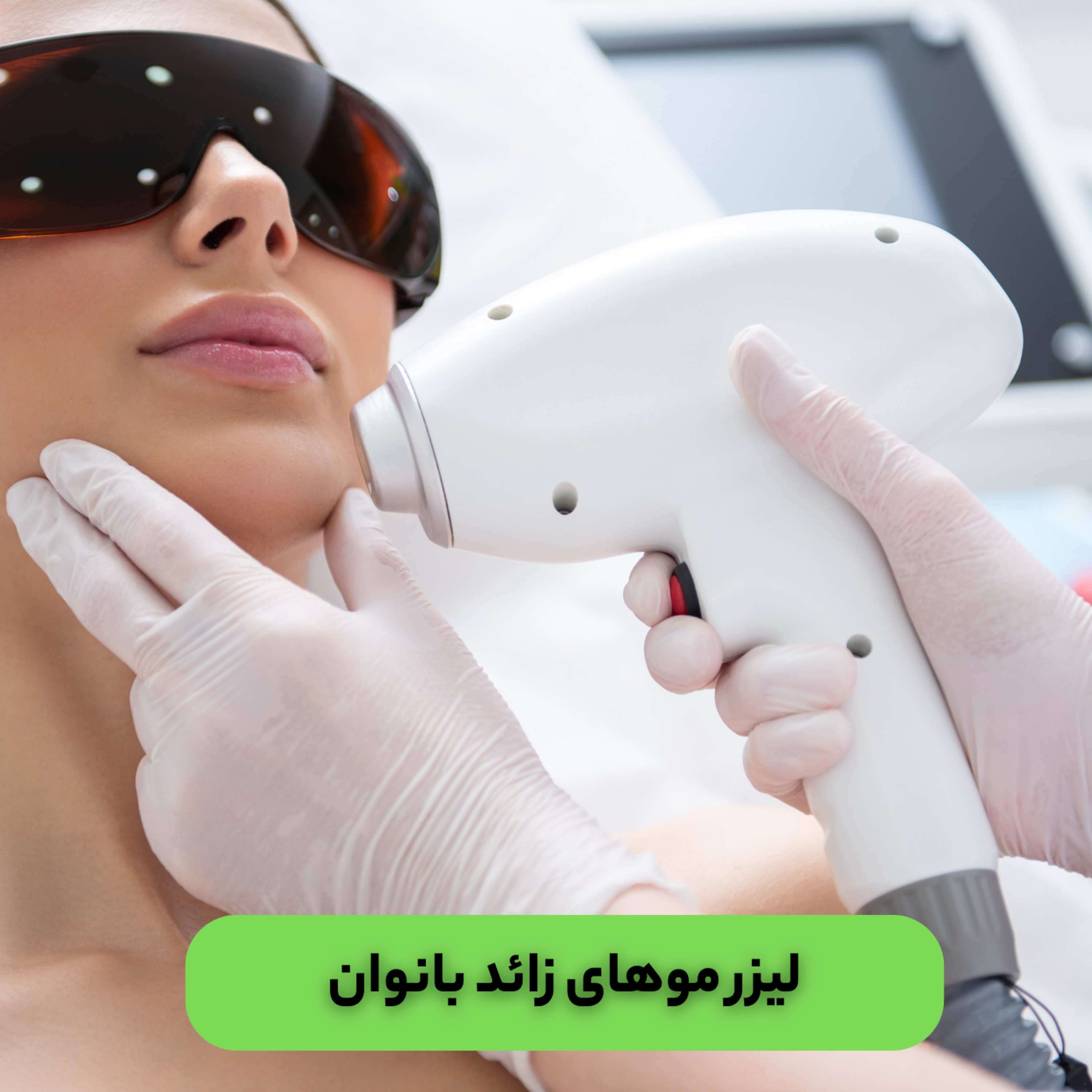کاور لیزر موهای زائد بانوان