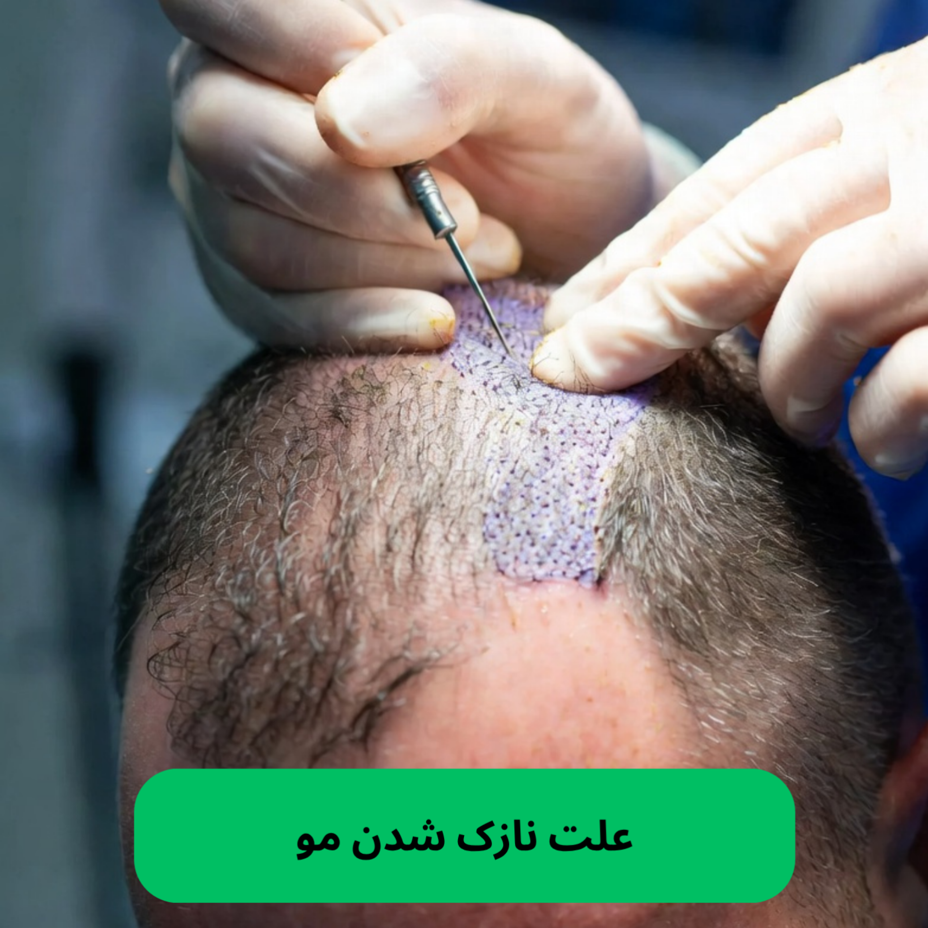 کاور ۱۰ علت نازک شدن مو و راهکارهای ساده درمان آن