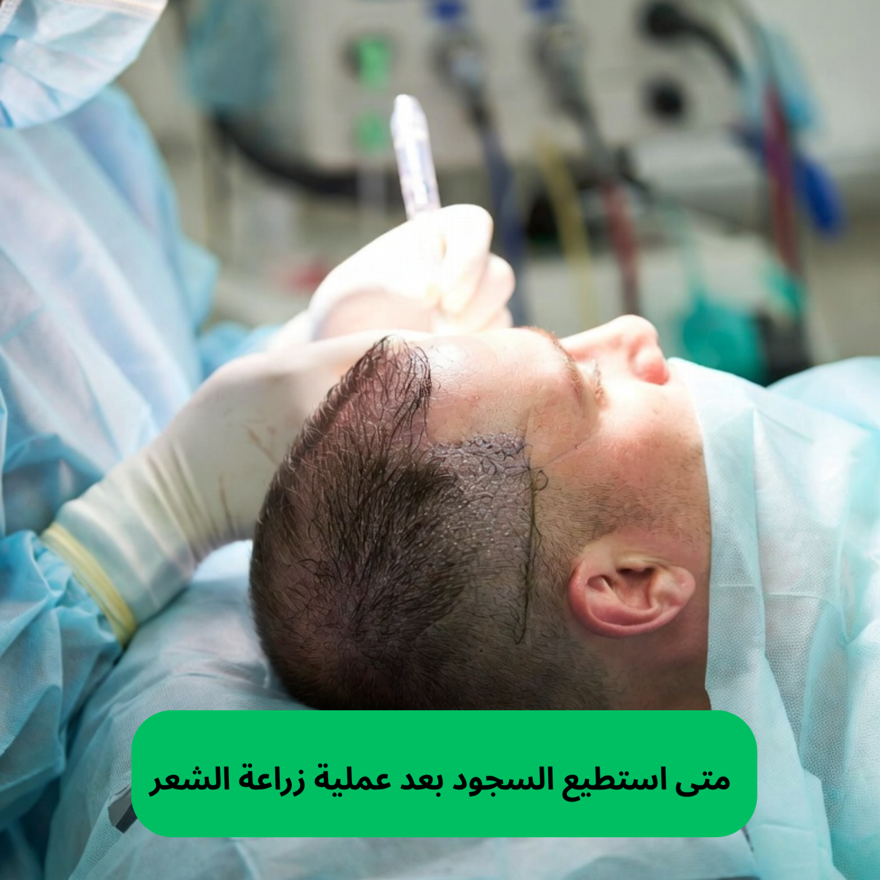 کاور متى استطيع السجود بعد عملية زراعة الشعر